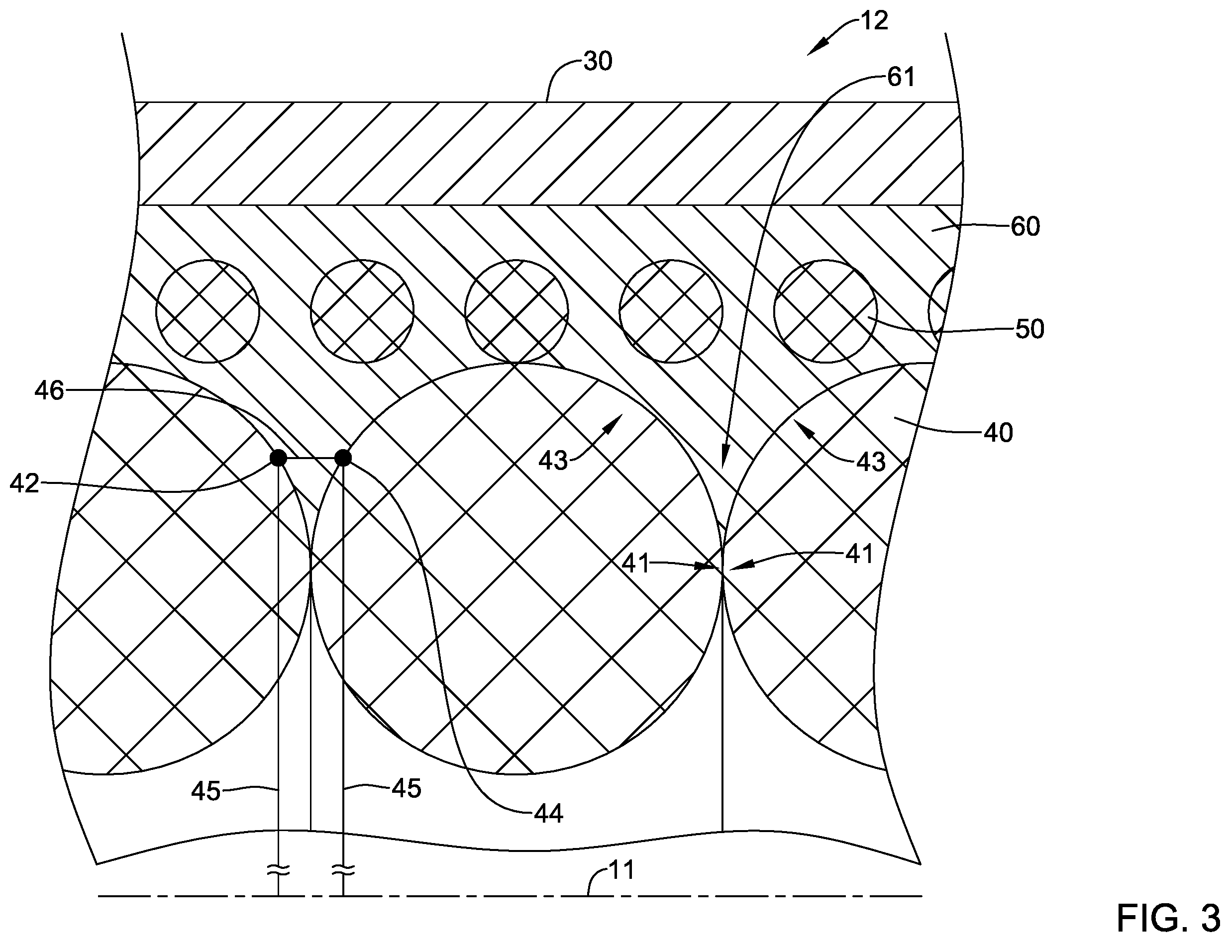 Patent US12551654 Figure 3 – Compression resistant sheath
