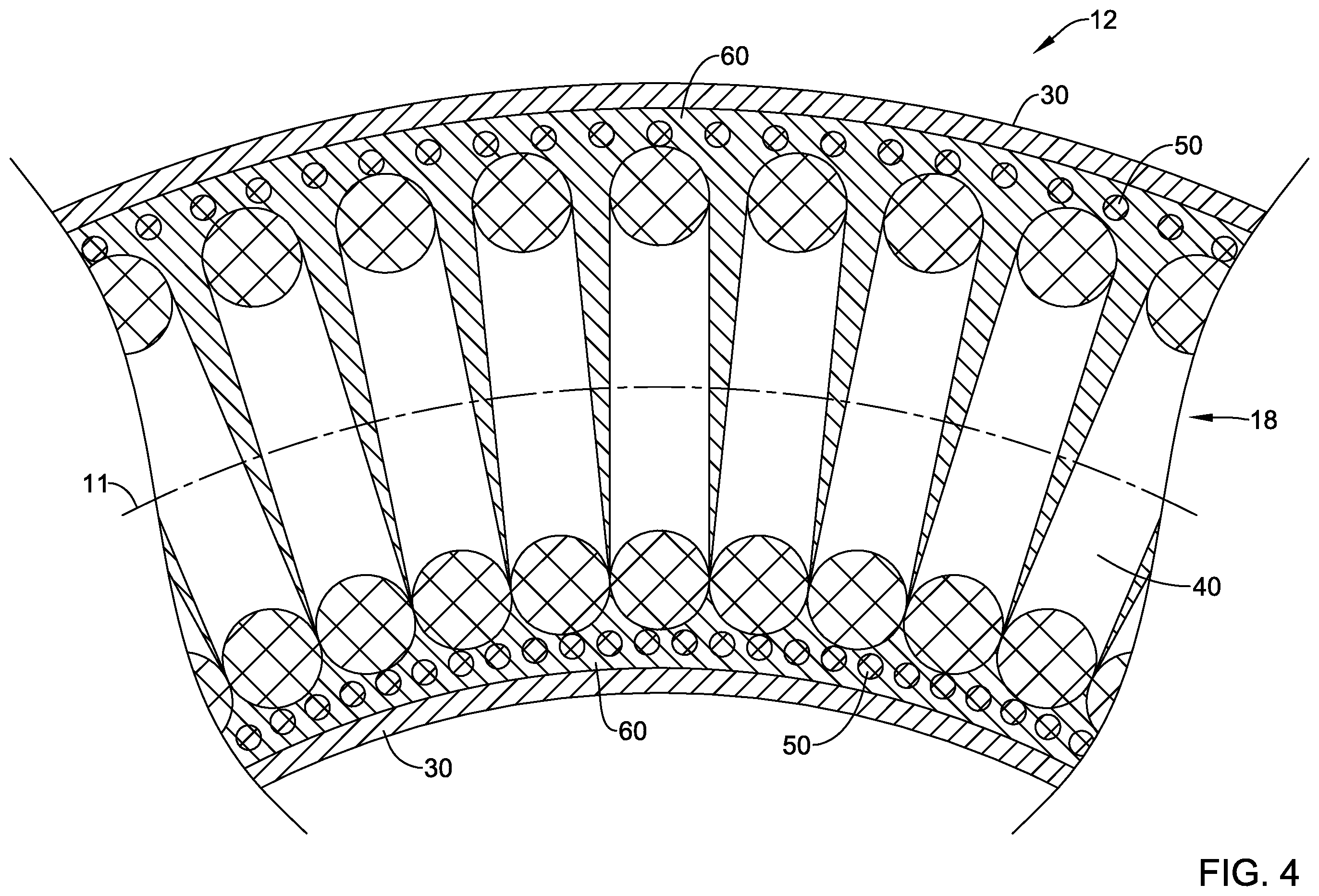Patent US12551654 Figure 4 – Compression resistant sheath