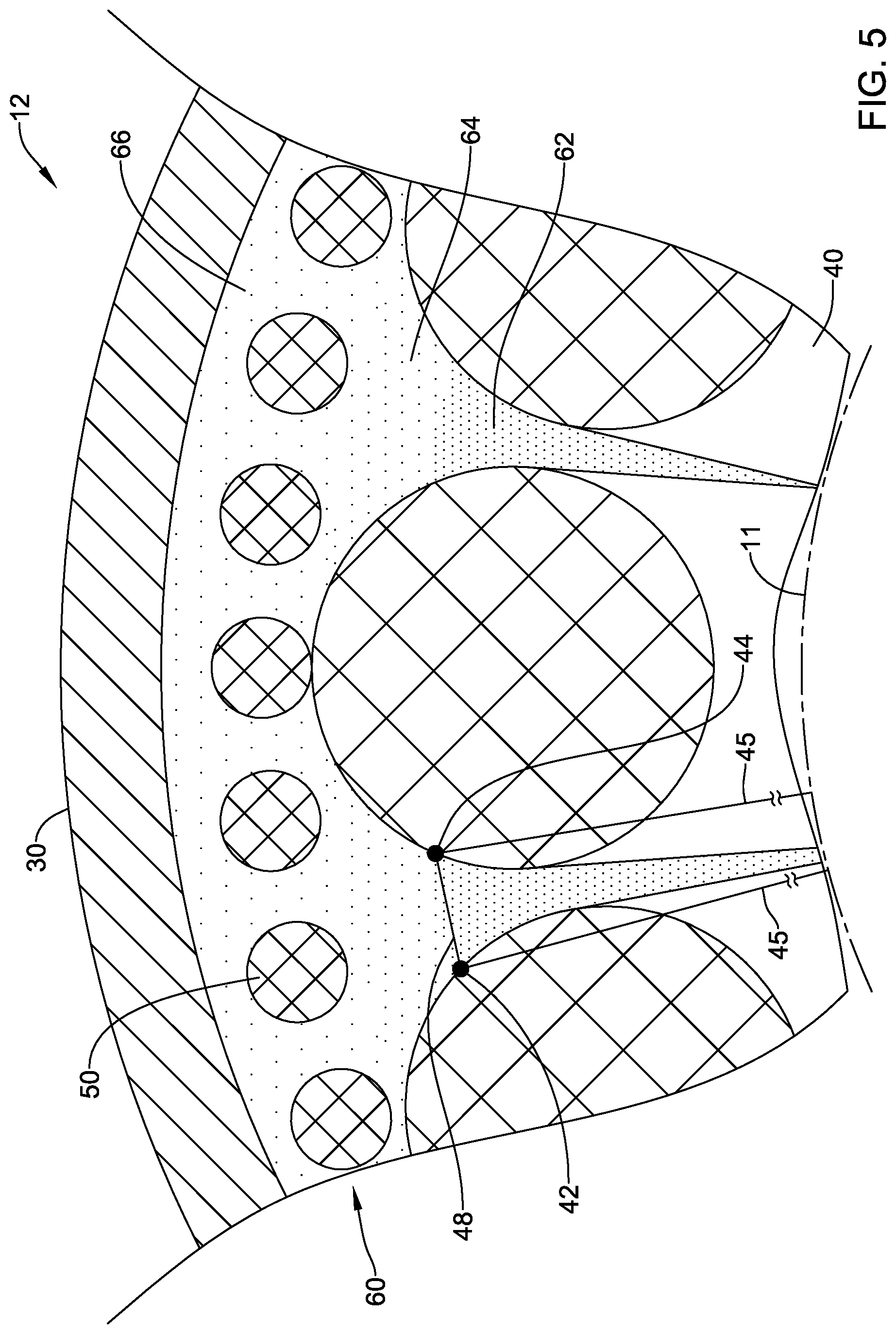 Patent US12551654 Figure 5 – Compression resistant sheath