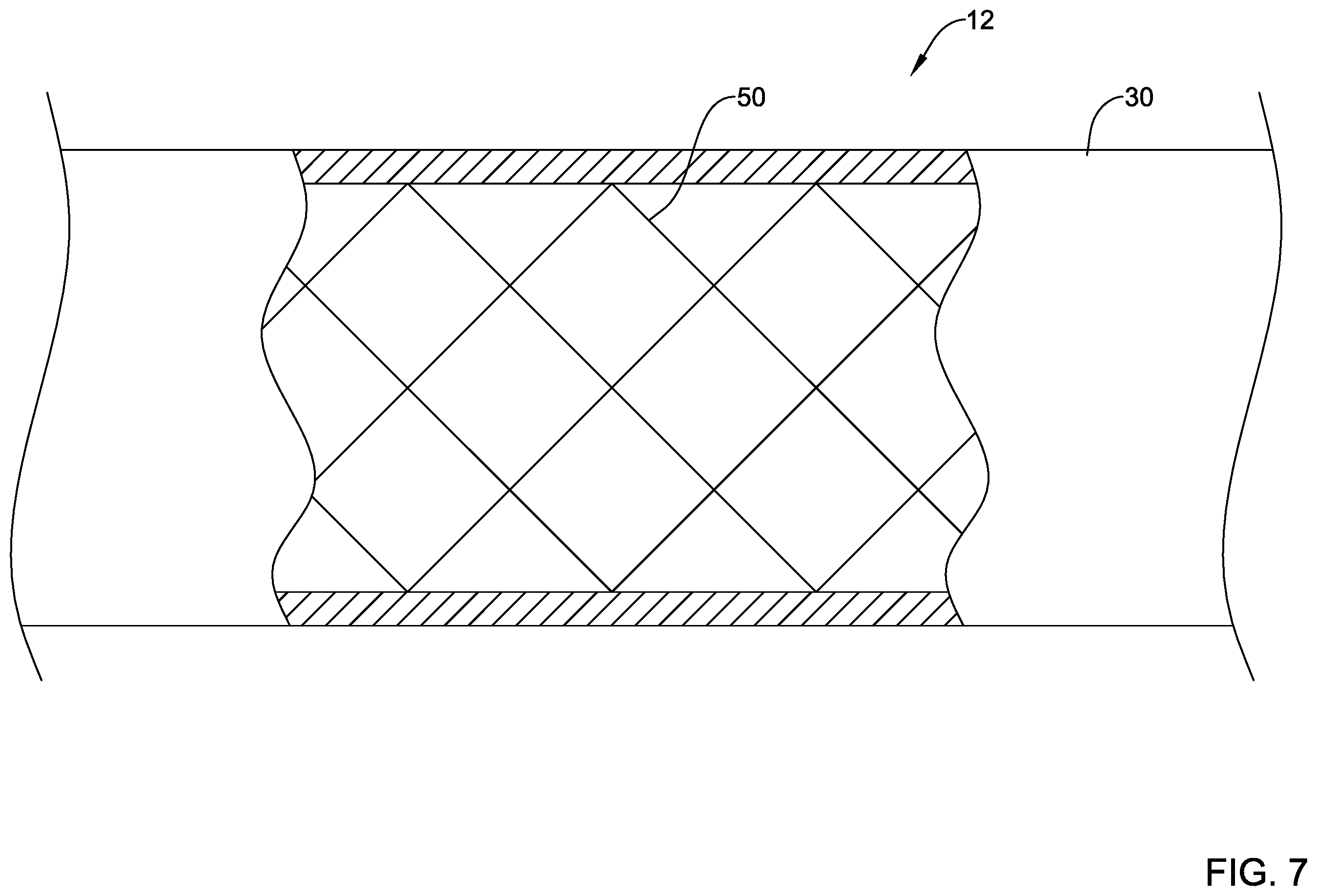 Patent US12551654 Figure 7 – Compression resistant sheath