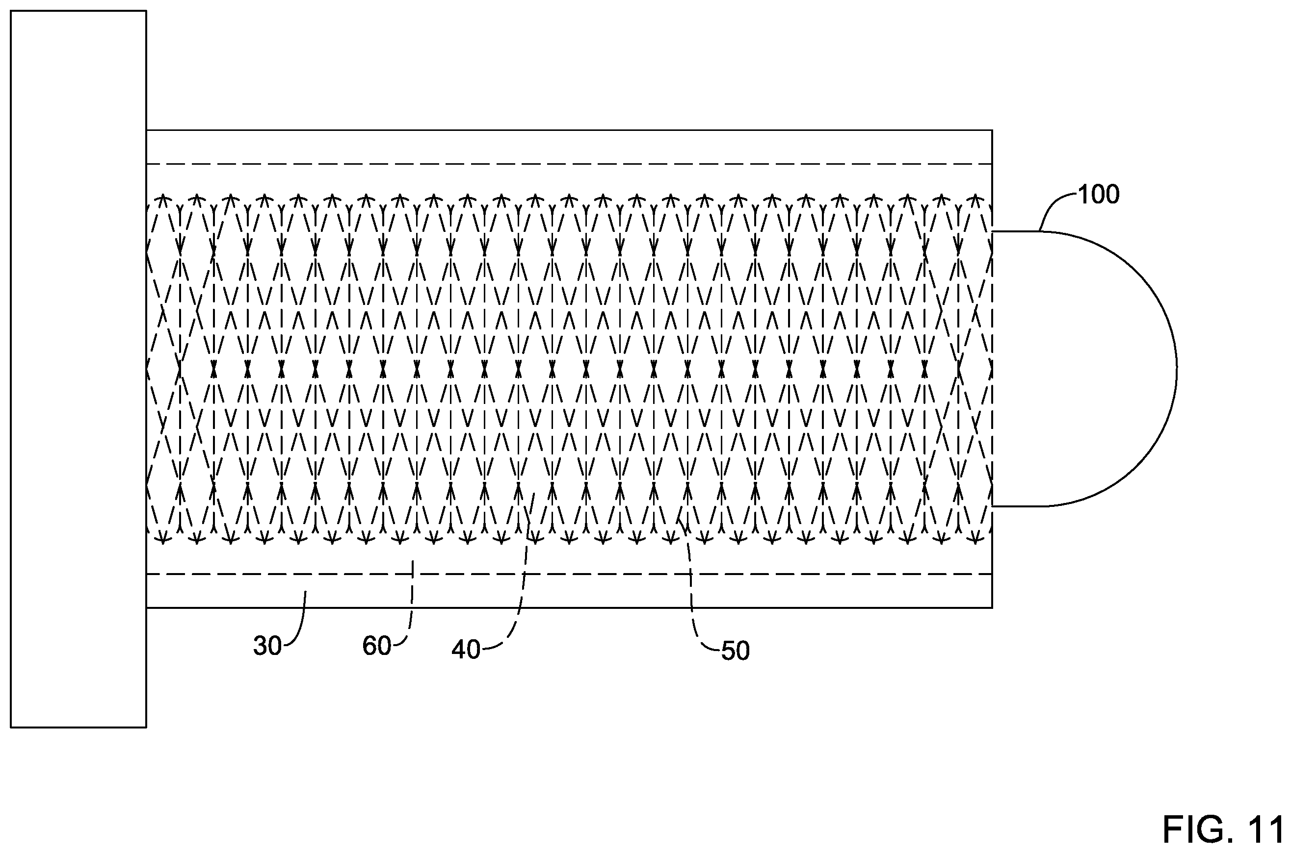 Patent US12551654 Figure 11 – Compression resistant sheath