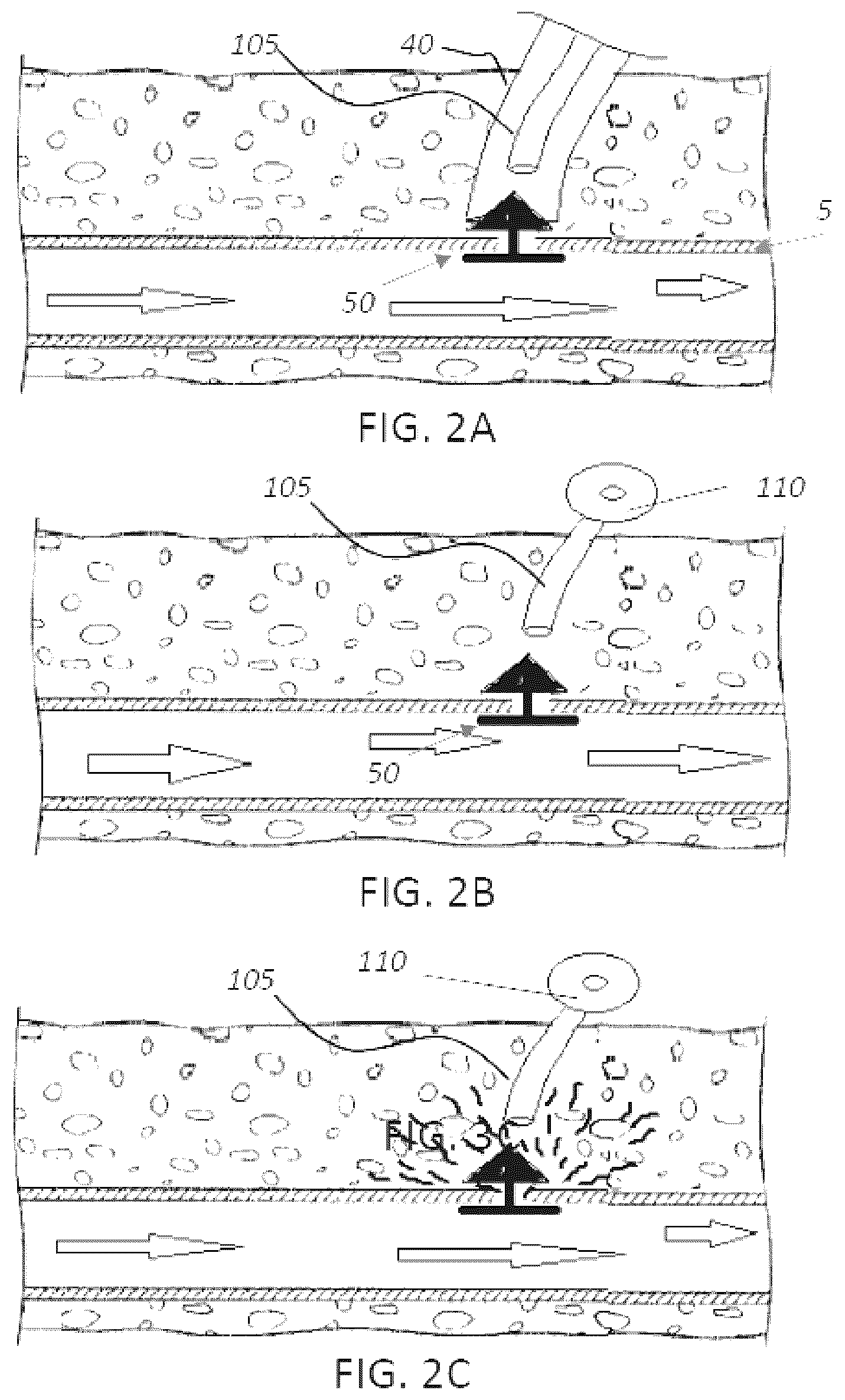 Patent US12551655 Figure 2 – Detection and pressure relief for percutaneous closure of a vessel