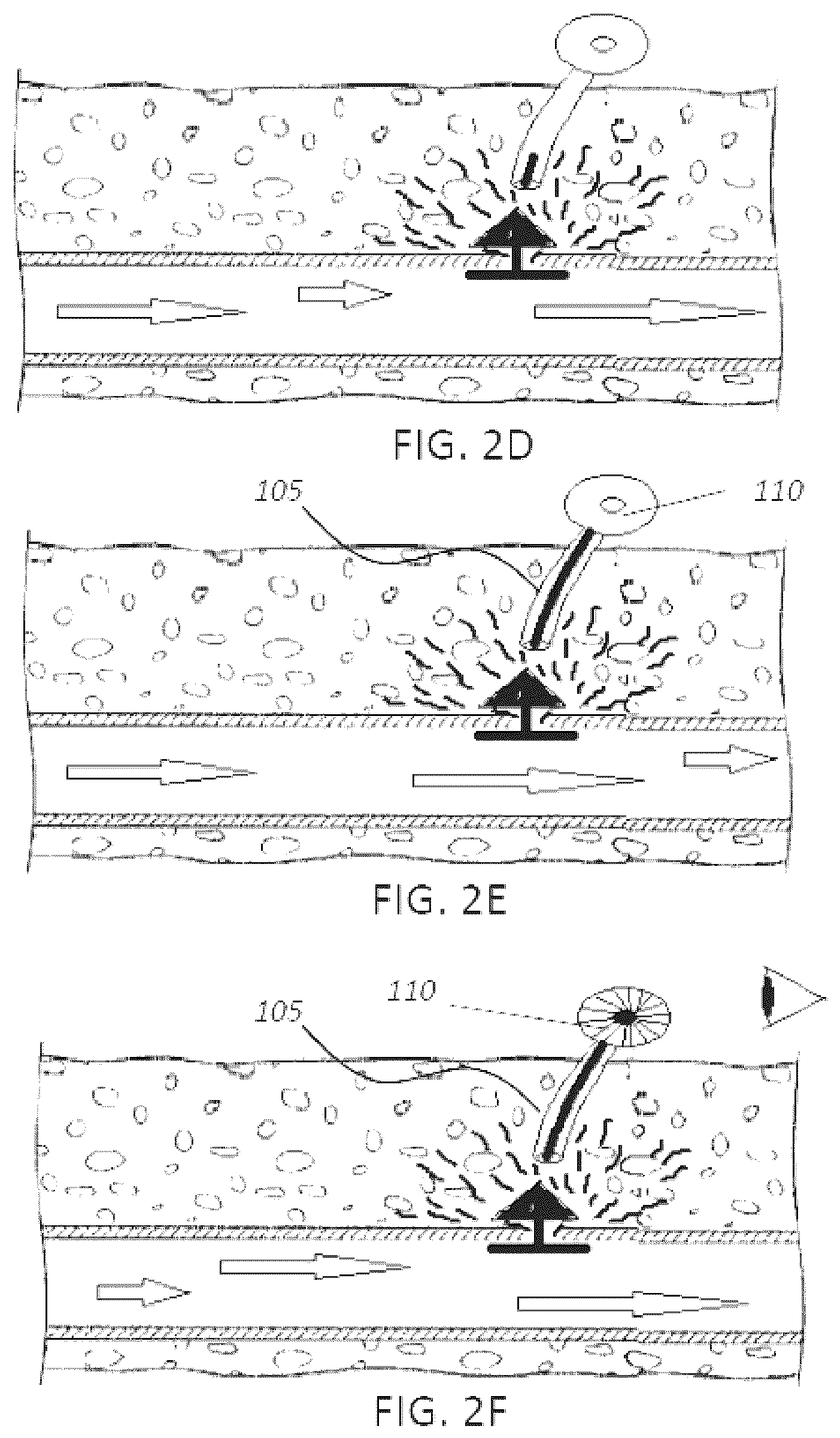Patent US12551655 Figure 3 – Detection and pressure relief for percutaneous closure of a vessel