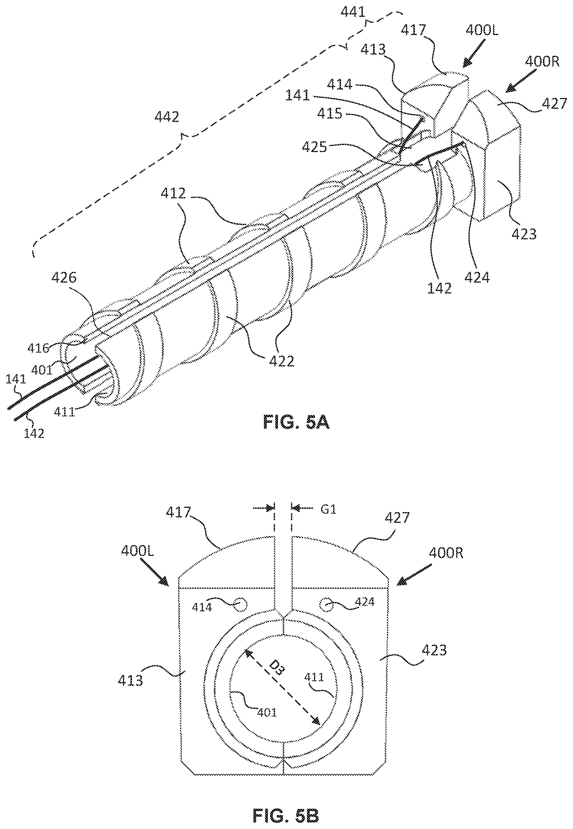 Patent US12551658 Figure 6 – Steerable introducer with slide block divider