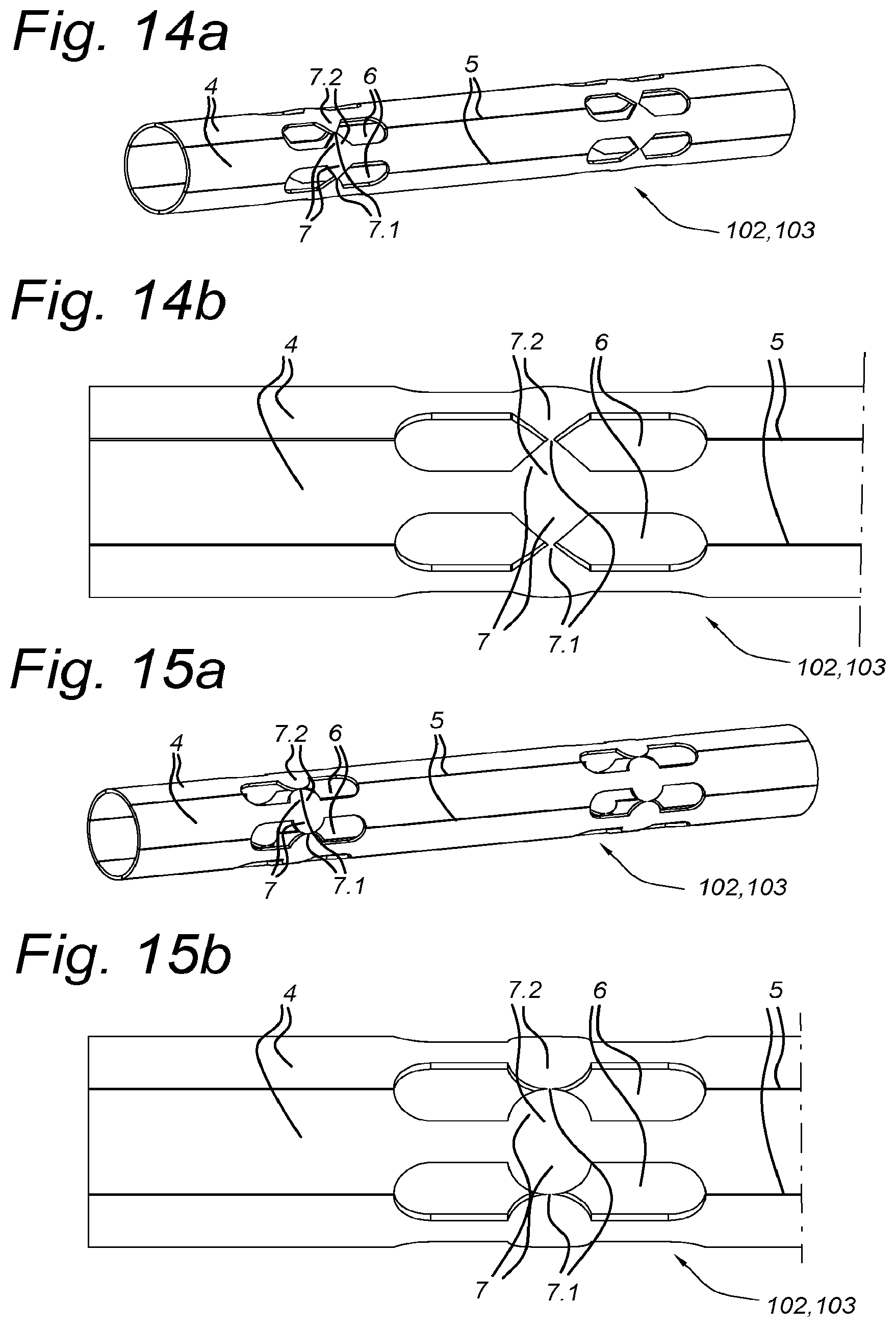 Patent US12551660 Figure 15 – Method for manufacturing a steerable instrument and such steerable instrument