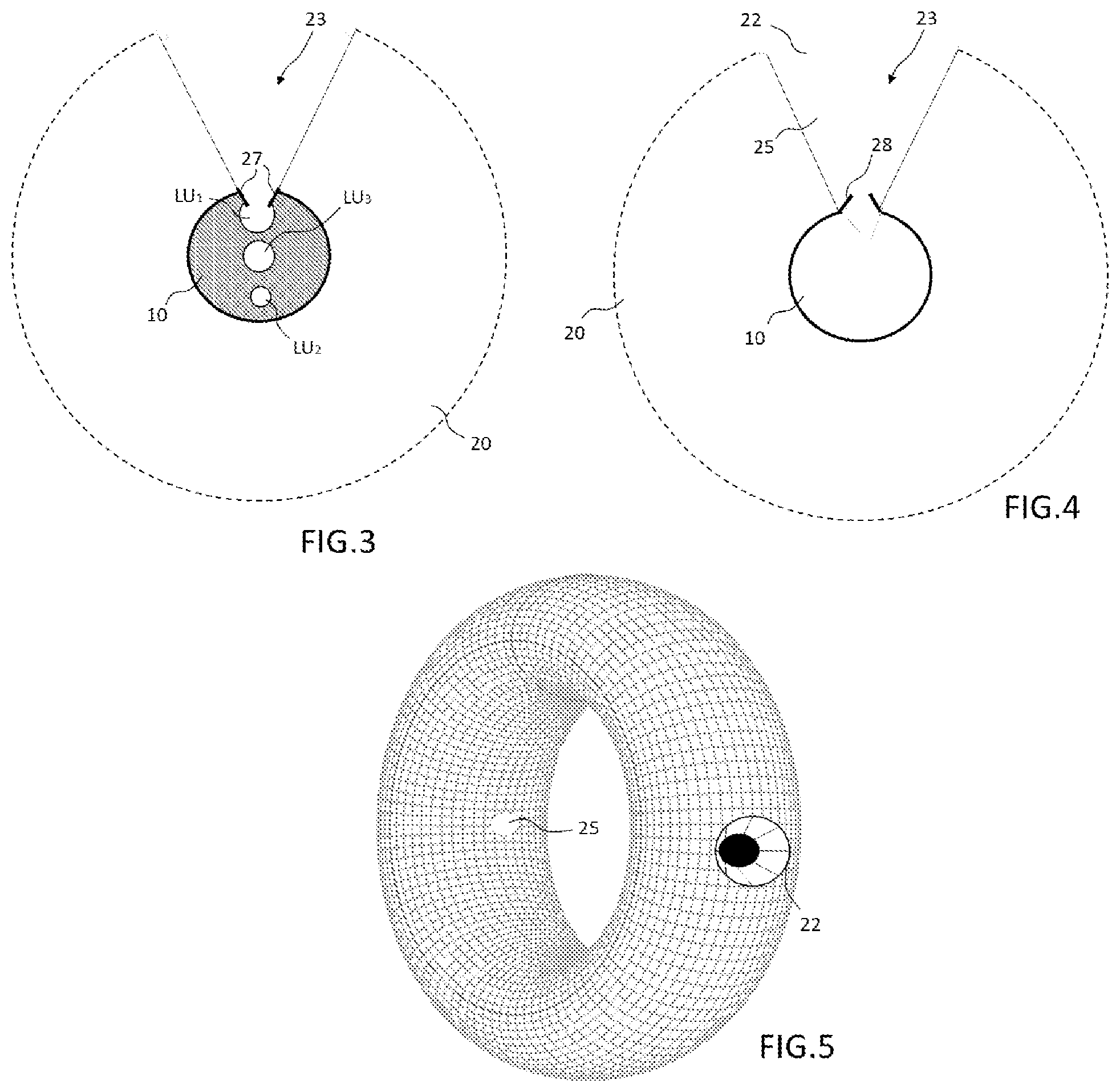 Patent US12551667 Figure 2 – Catheter, inflatable balloon for a catheter