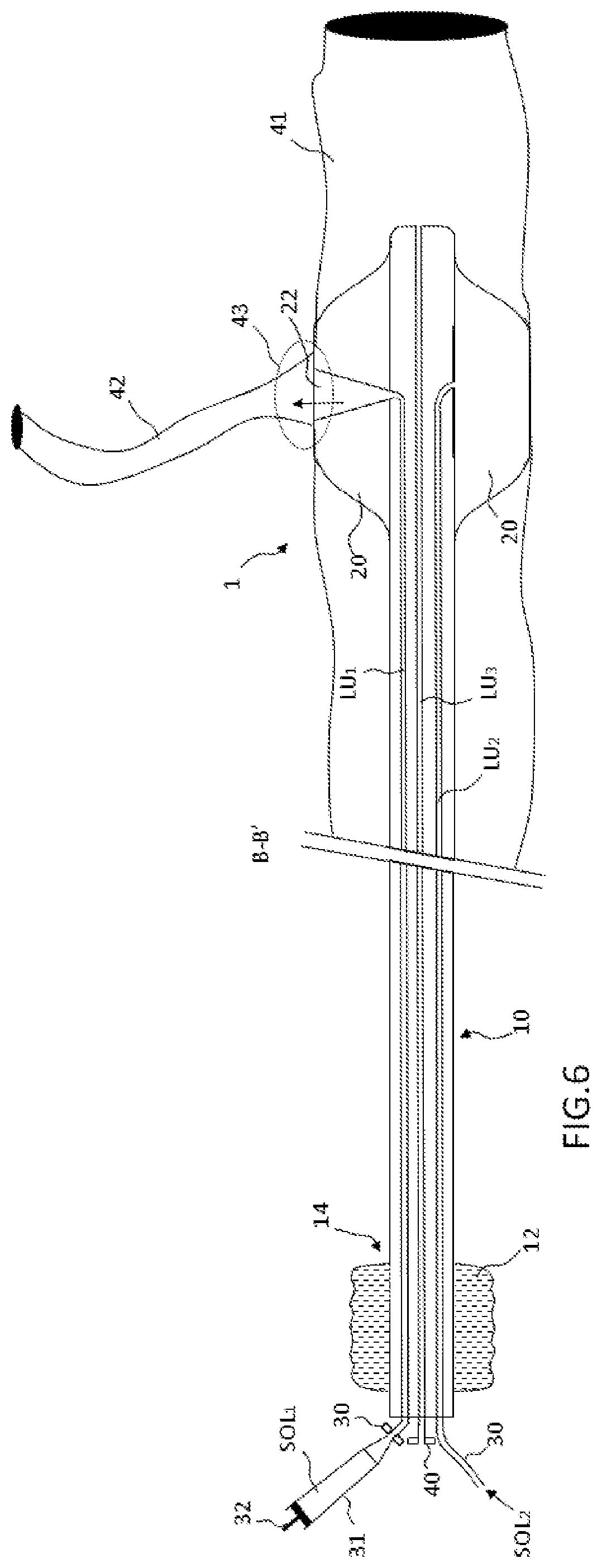 Patent US12551667 Figure 3 – Catheter, inflatable balloon for a catheter