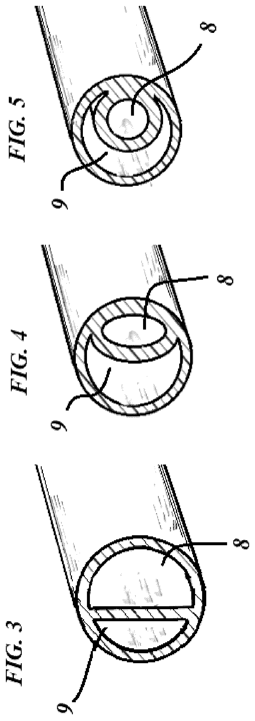 Patent US12551668 Figure 2 – Angioplasty balloon catheter comprising a biaxial-coaxial transition