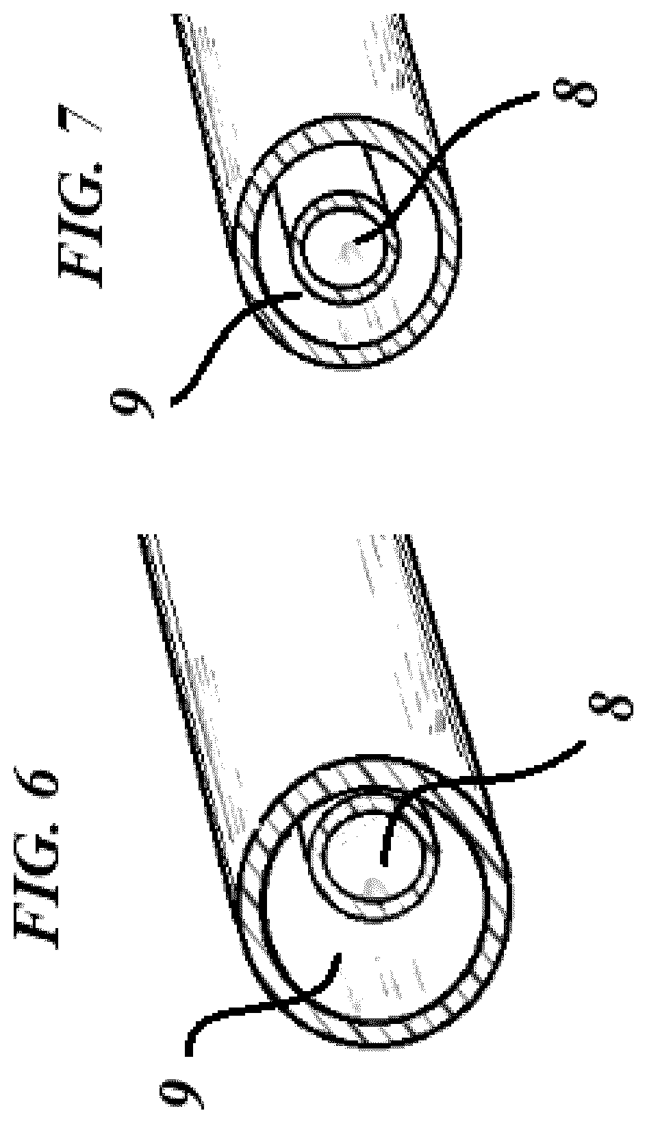Patent US12551668 Figure 3 – Angioplasty balloon catheter comprising a biaxial-coaxial transition