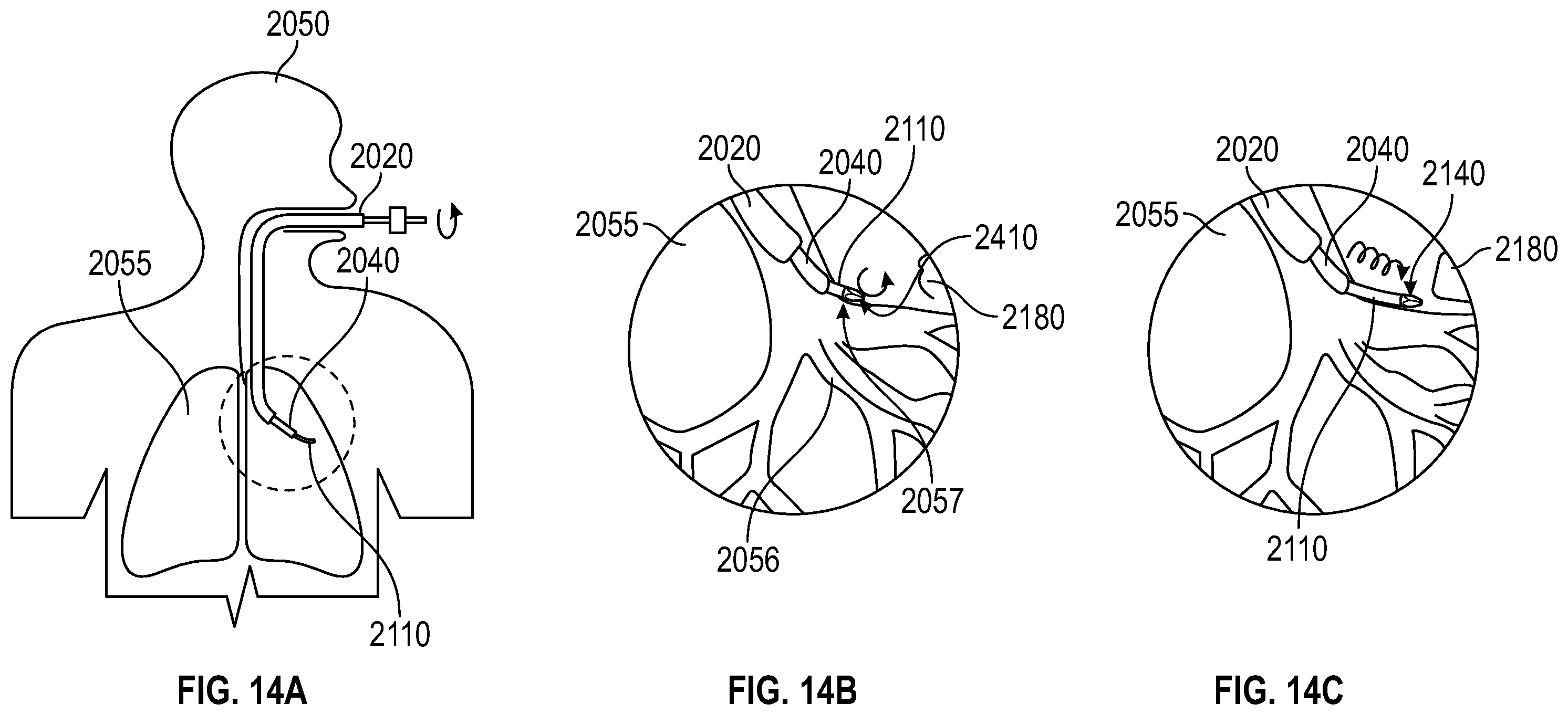 Patent US12551671 Figure 14 – Surgical dilators and assemblies and methods thereof