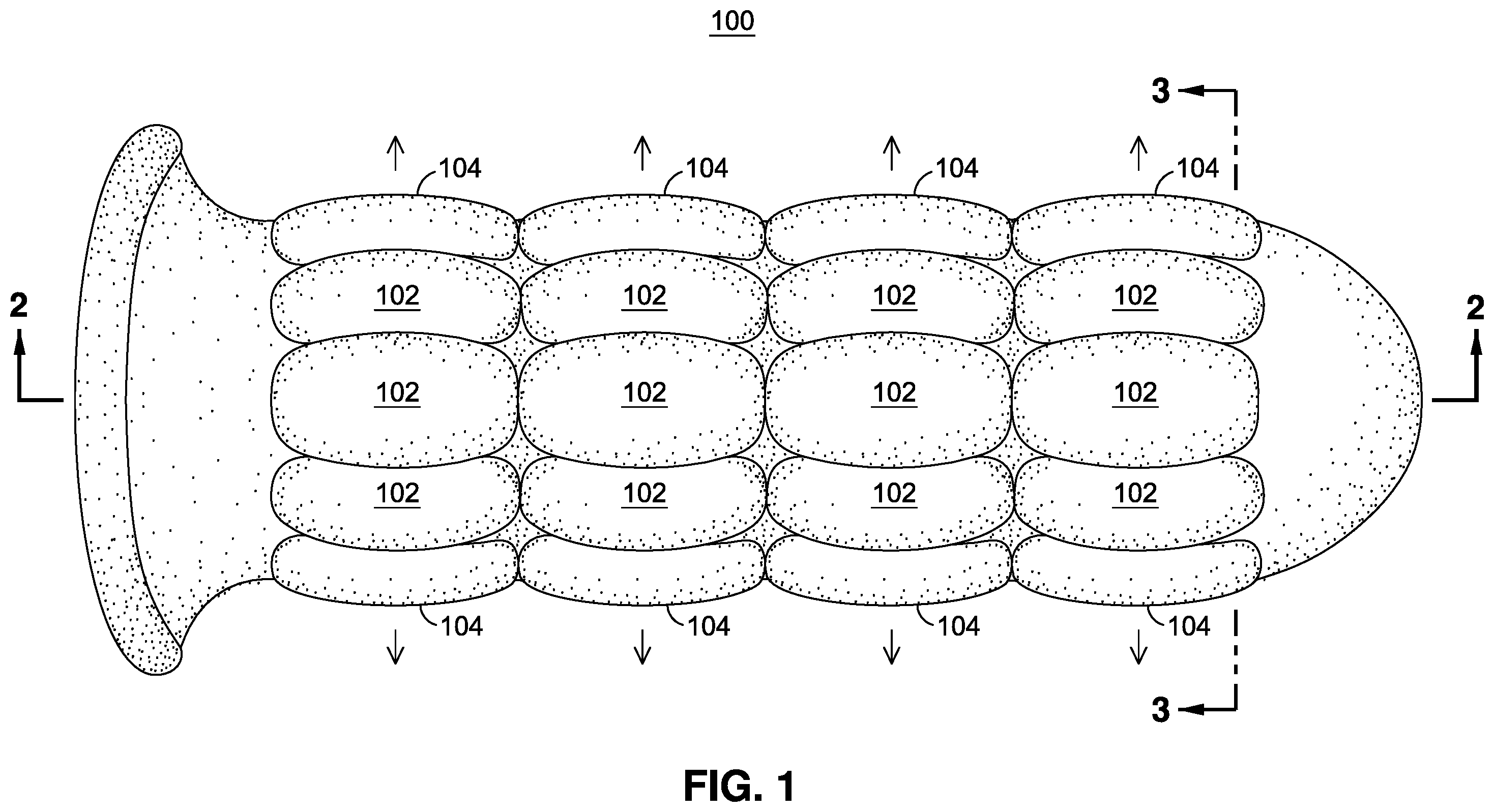 Patent US12551673 — Systems and methods for improved enhanced dilation devices for targeted dilatation diagnostics and therapies — Figure 1