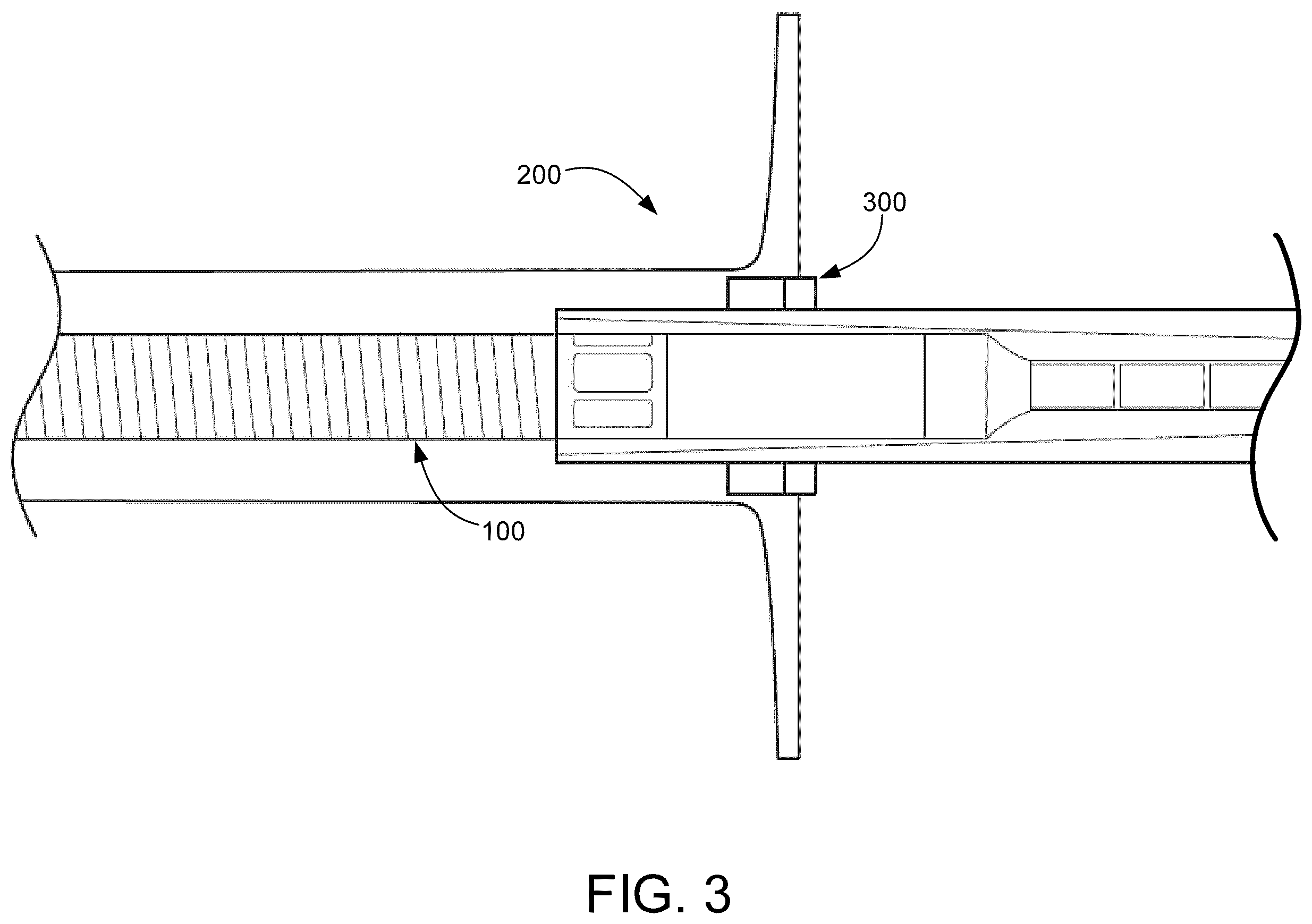 Patent US12551677 Figure 3 – Peel away hemostasis valve