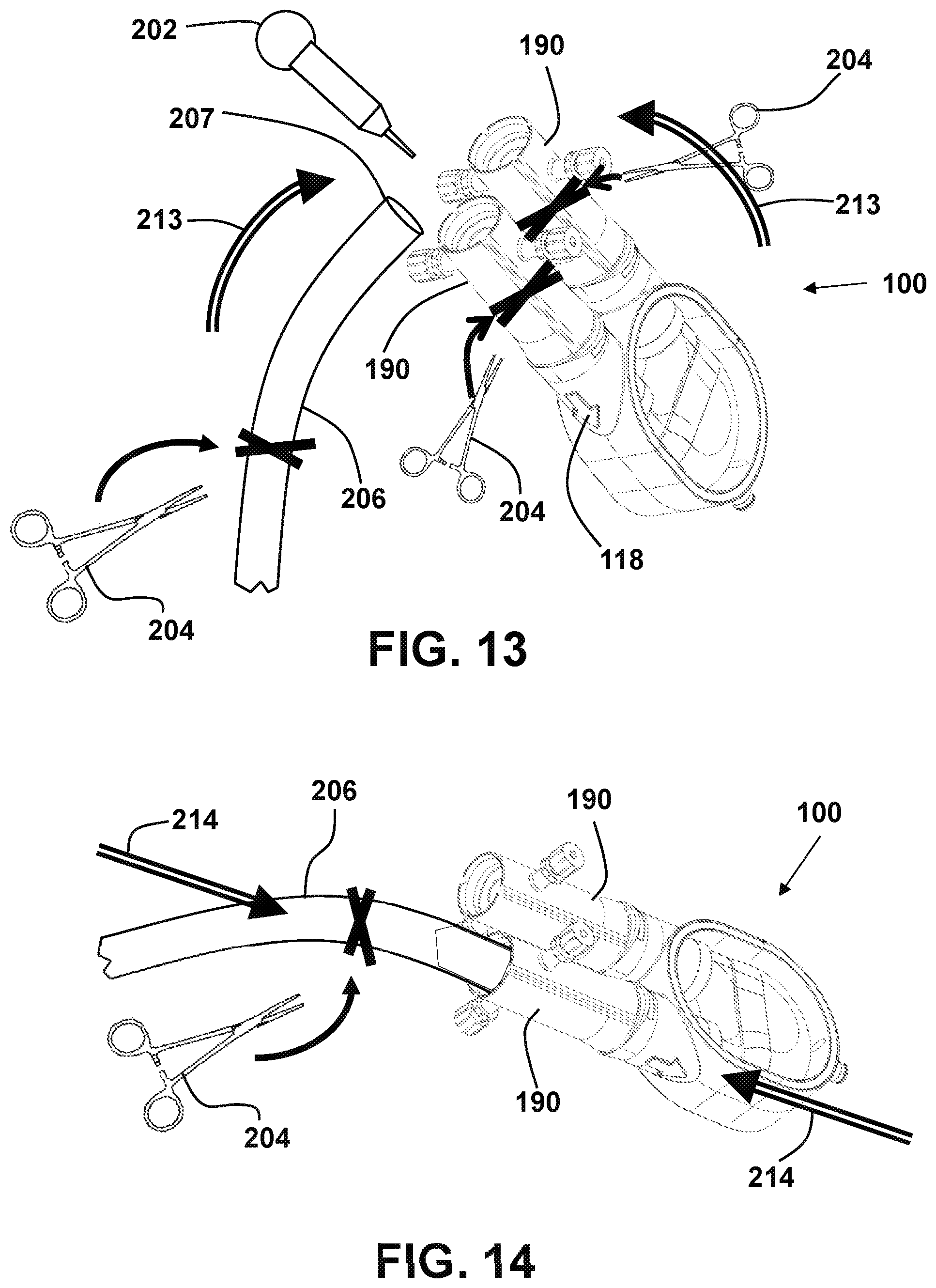 Patent US12551686 Figure 13 – Ventricular assist devices and methods
