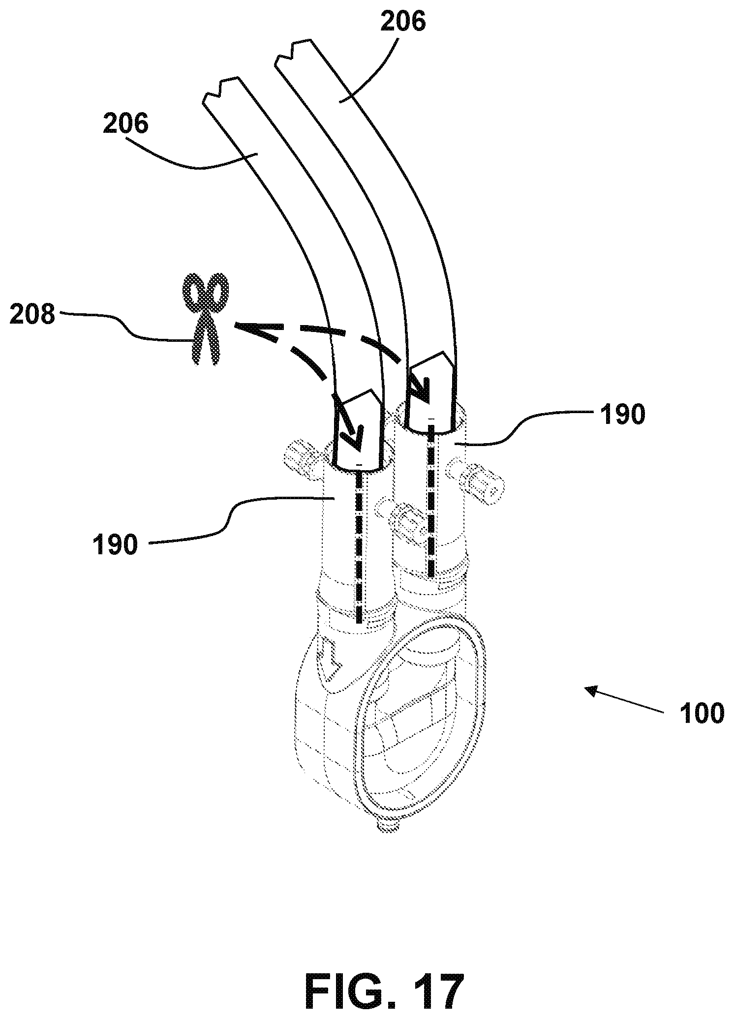 Patent US12551686 Figure 15 – Ventricular assist devices and methods