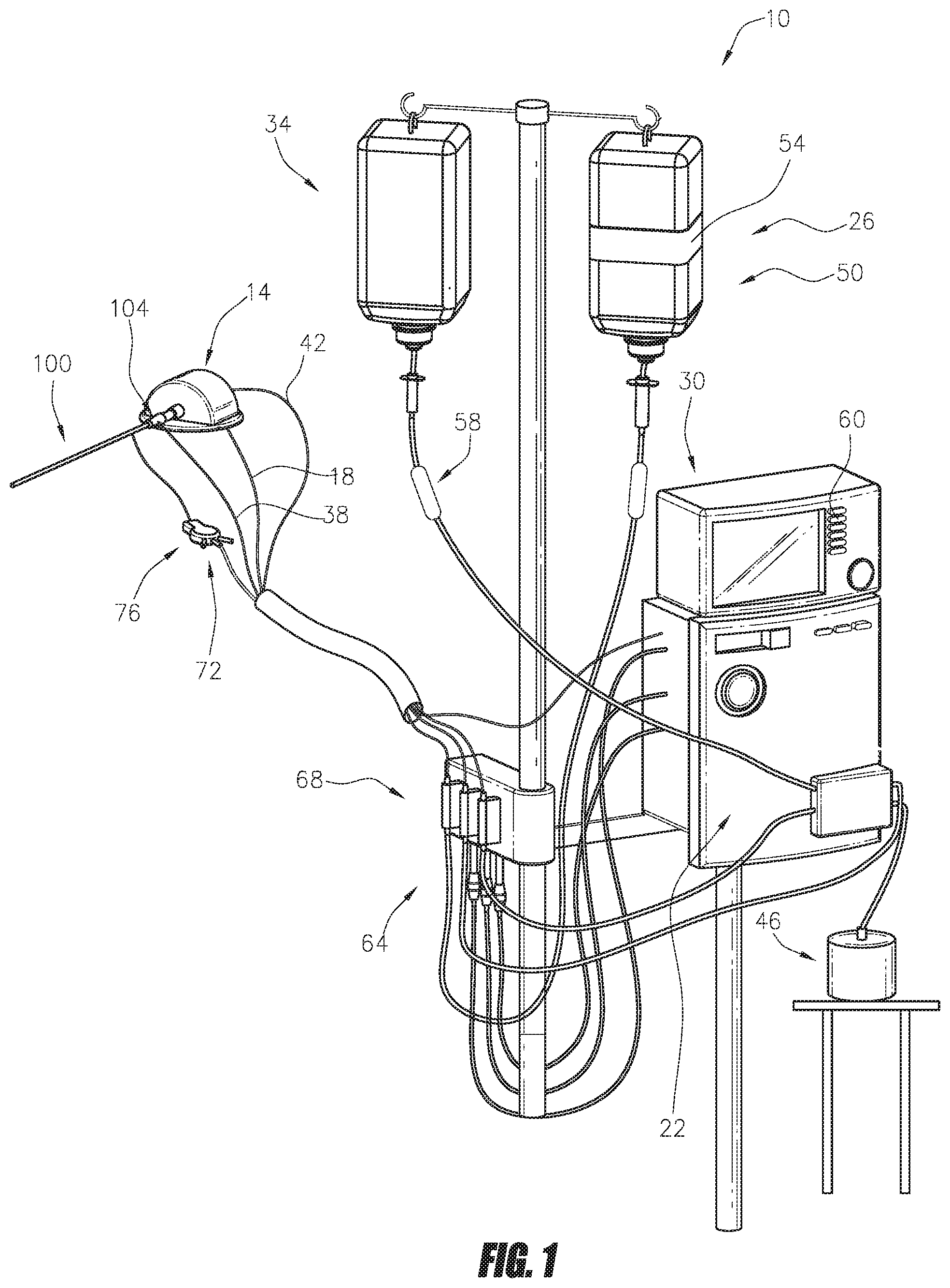 Patent US12551688 Figure 1 – Heart pump providing adjustable outflow