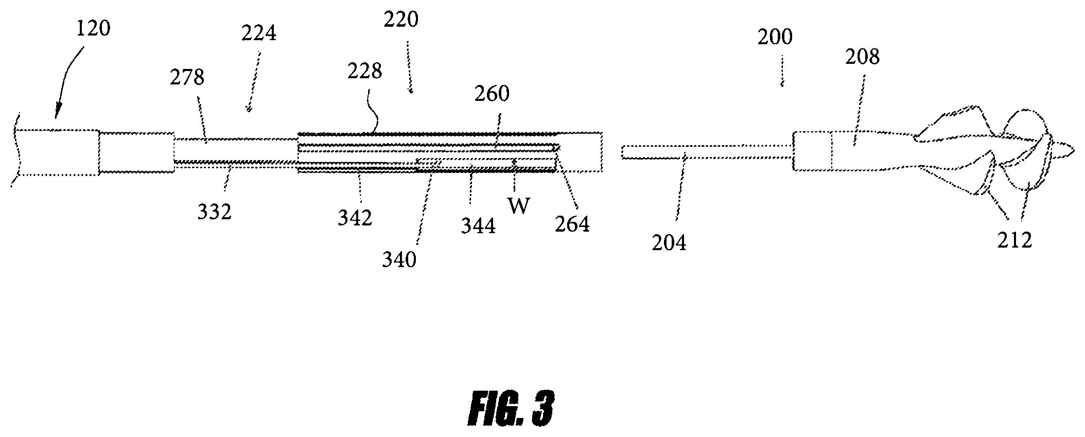 Patent US12551688 Figure 4 – Heart pump providing adjustable outflow