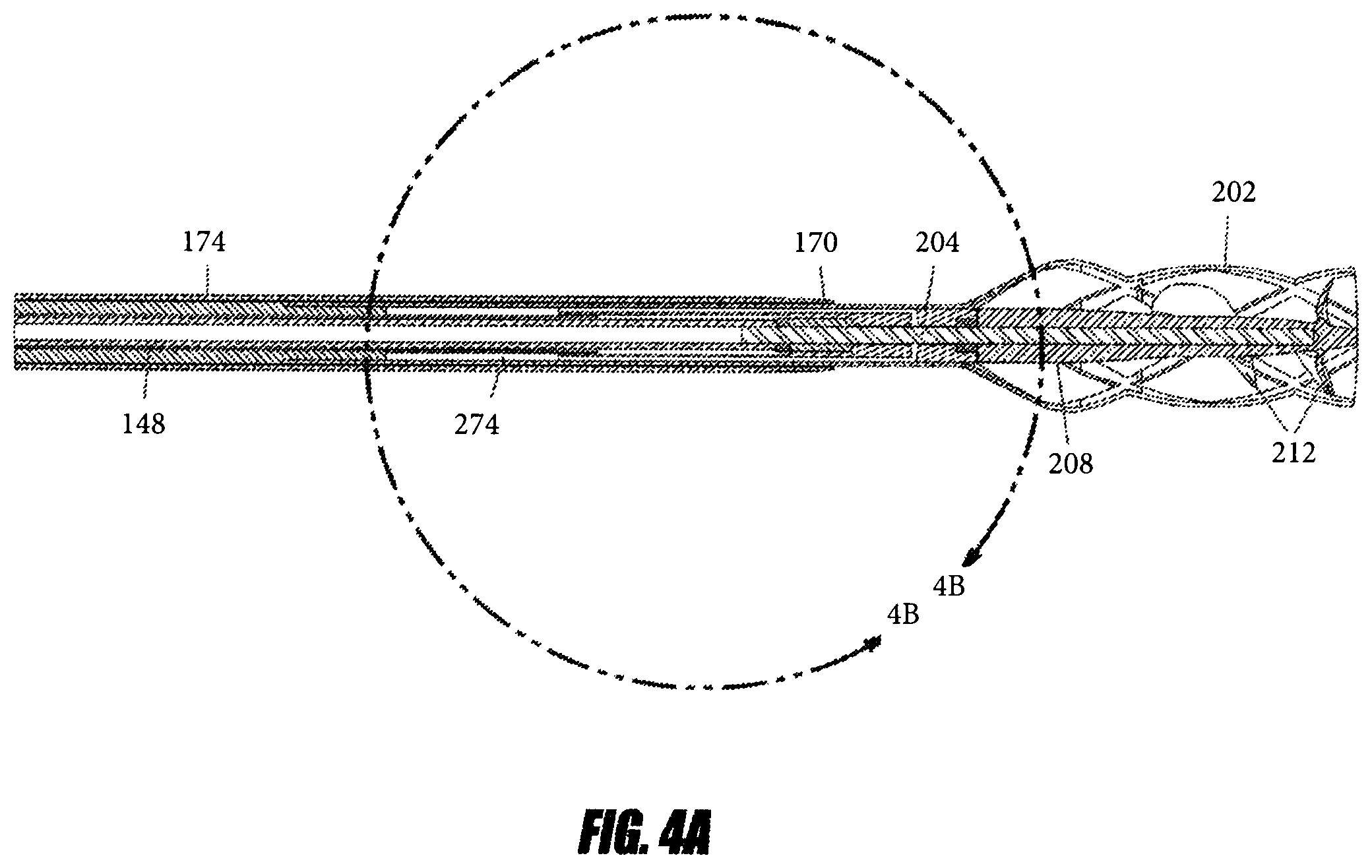 Patent US12551688 Figure 5 – Heart pump providing adjustable outflow