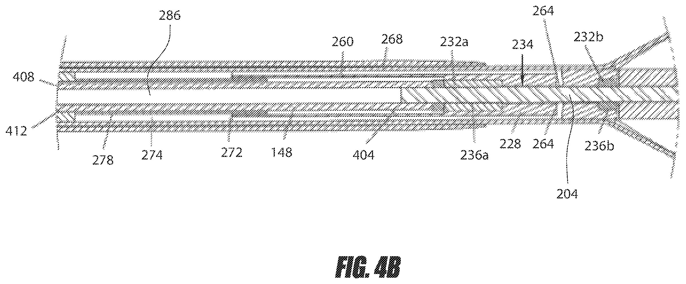 Patent US12551688 Figure 6 – Heart pump providing adjustable outflow