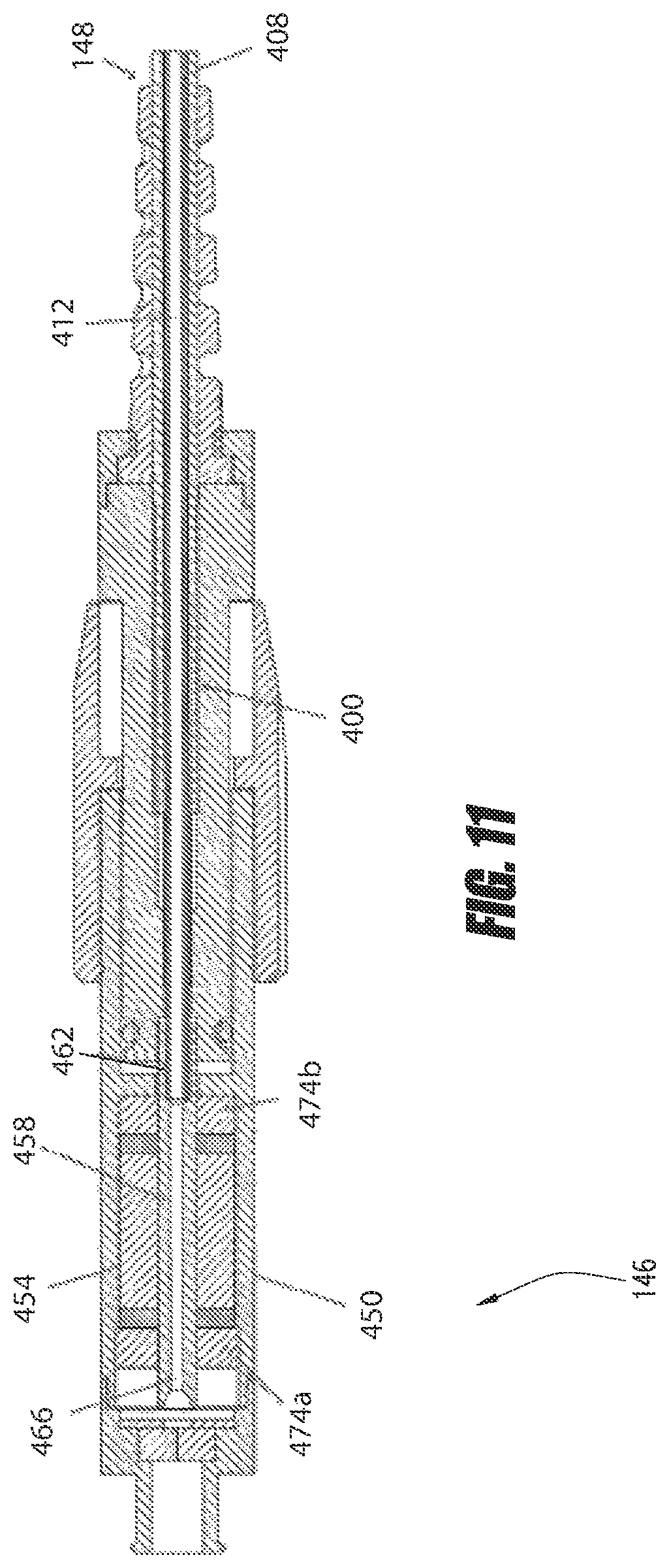 Patent US12551688 Figure 13 – Heart pump providing adjustable outflow