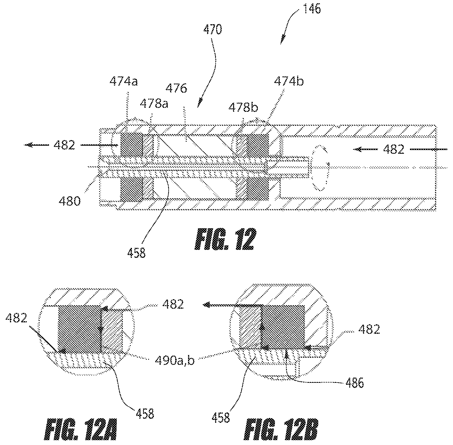 Patent US12551688 Figure 14 – Heart pump providing adjustable outflow