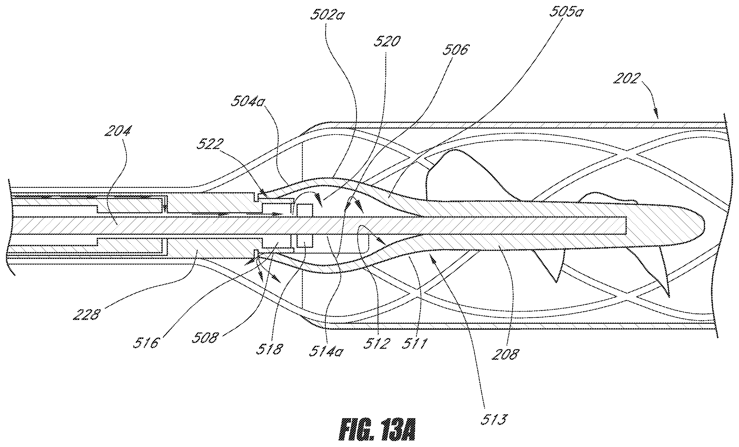 Patent US12551688 Figure 15 – Heart pump providing adjustable outflow