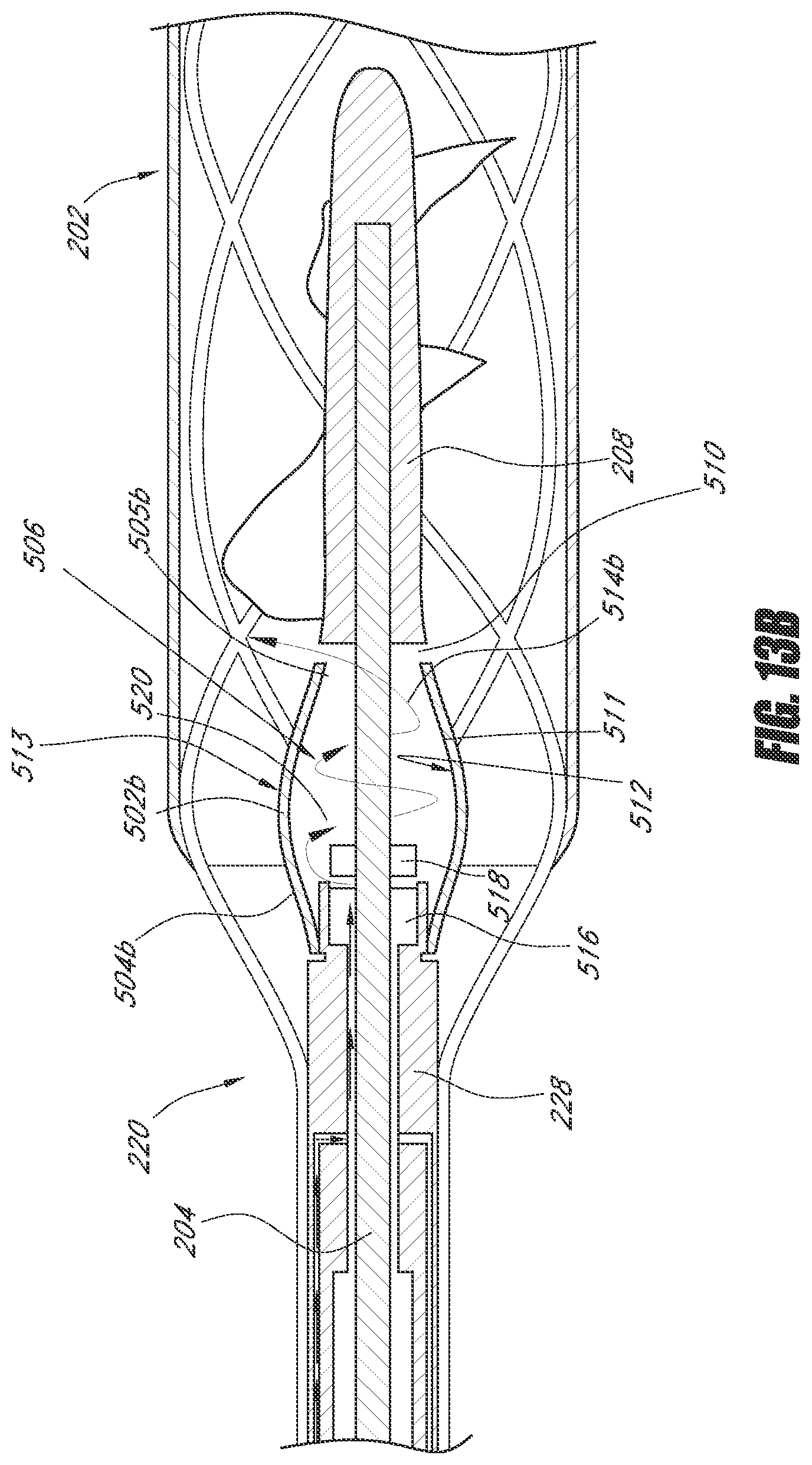 Patent US12551688 Figure 16 – Heart pump providing adjustable outflow