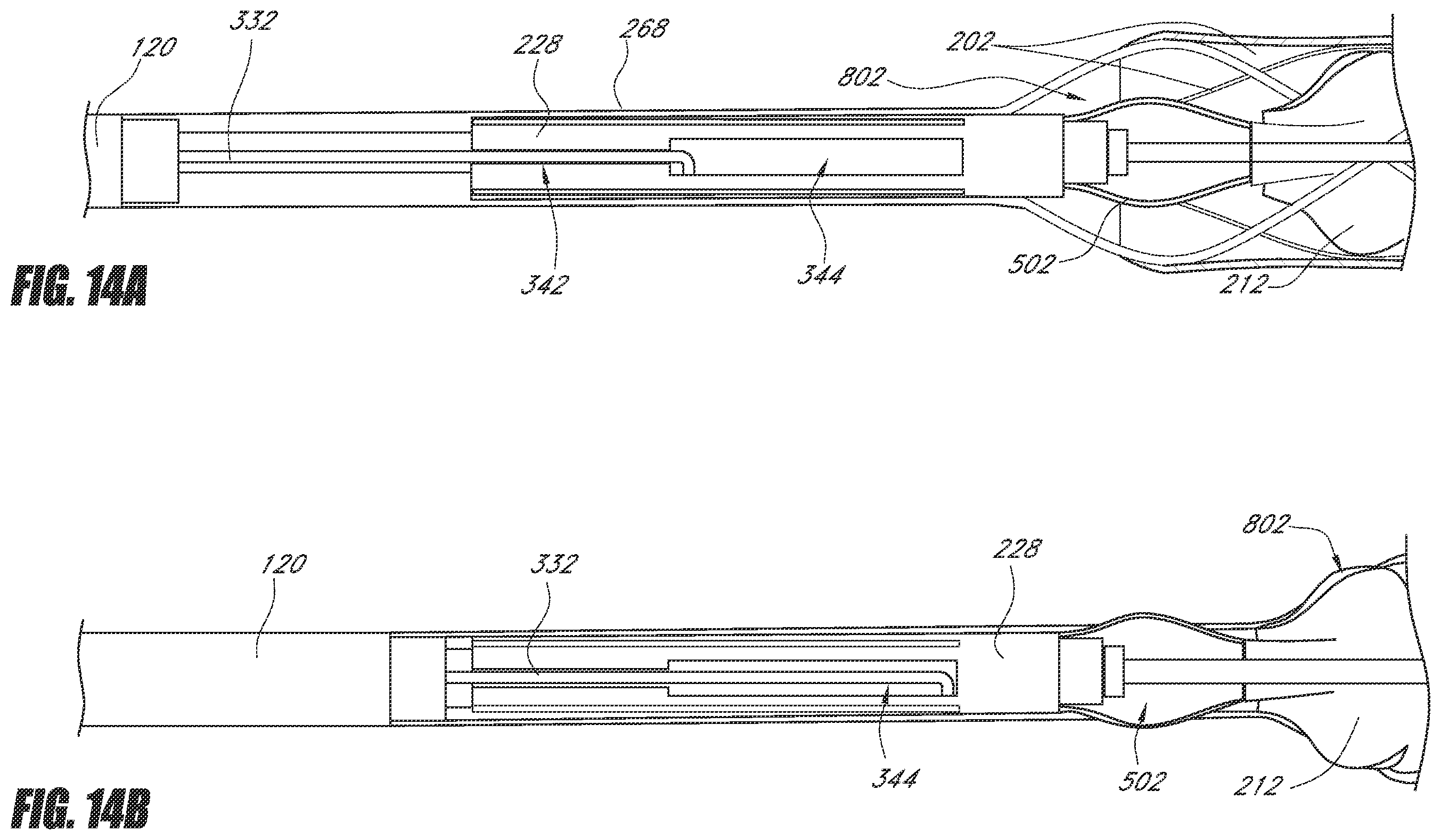 Patent US12551688 Figure 17 – Heart pump providing adjustable outflow