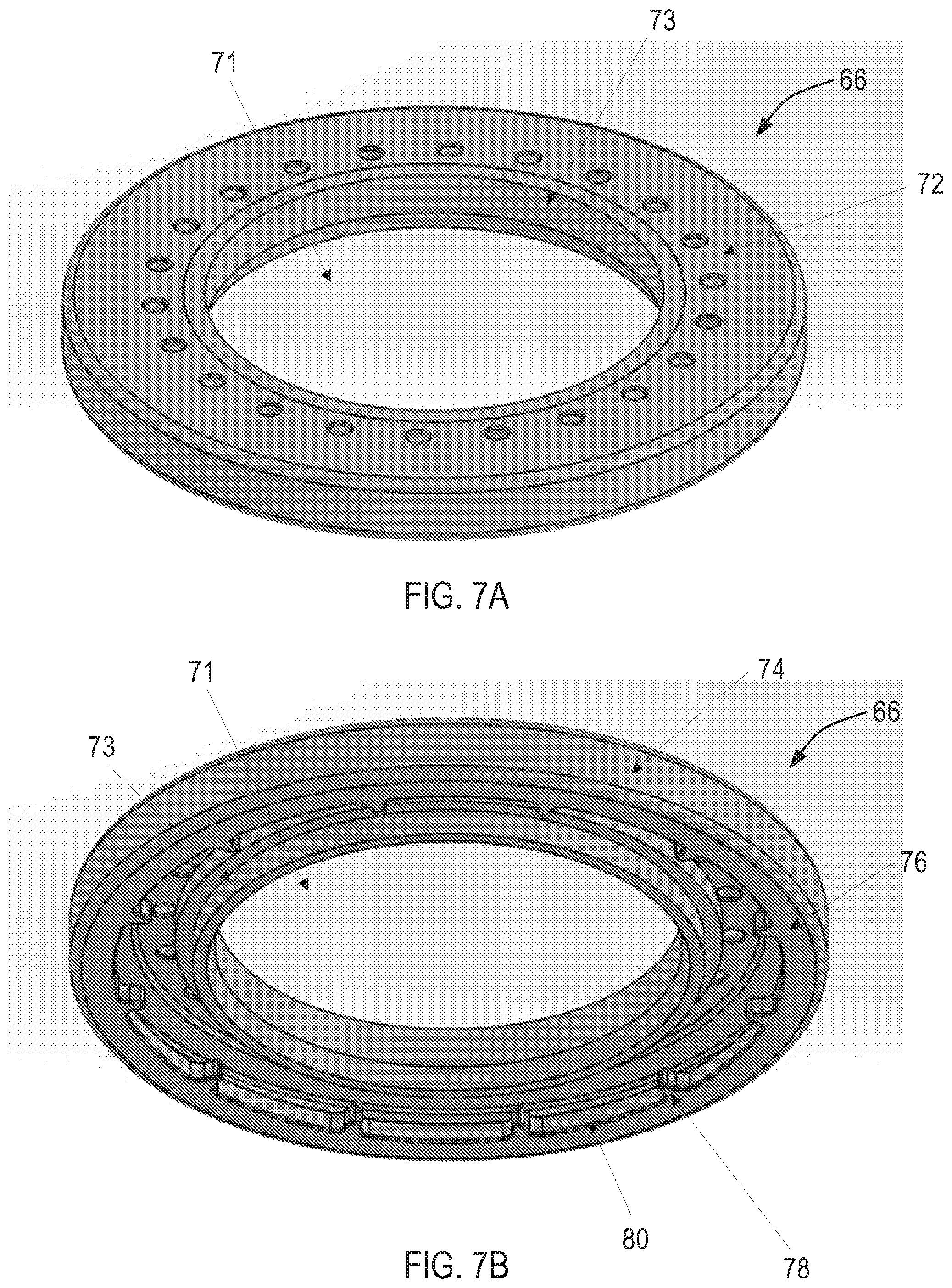 Patent US12551689 Figure 7 – Apparatus and methods for coupling a blood pump to the heart