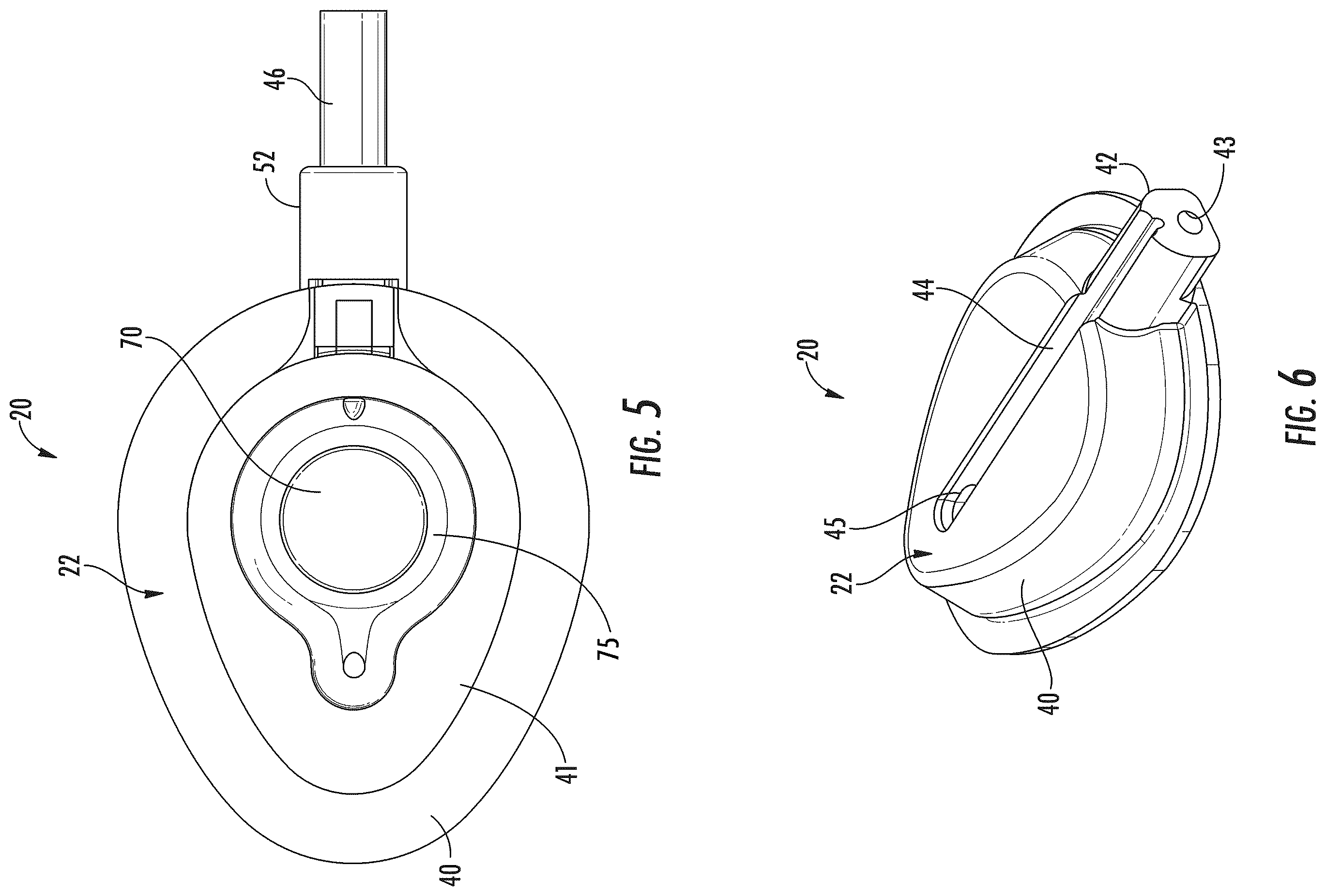Patent US12551691 Figure 4 – Implantable reservoir for use with a medical device and system for interventional drug delivery