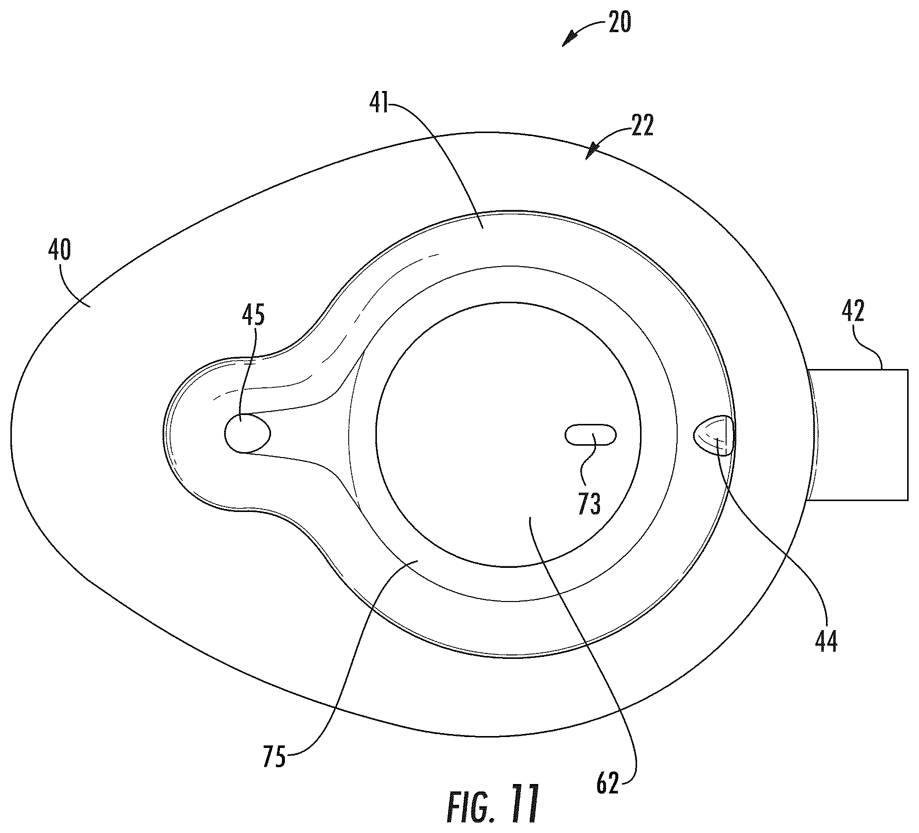 Patent US12551691 Figure 7 – Implantable reservoir for use with a medical device and system for interventional drug delivery