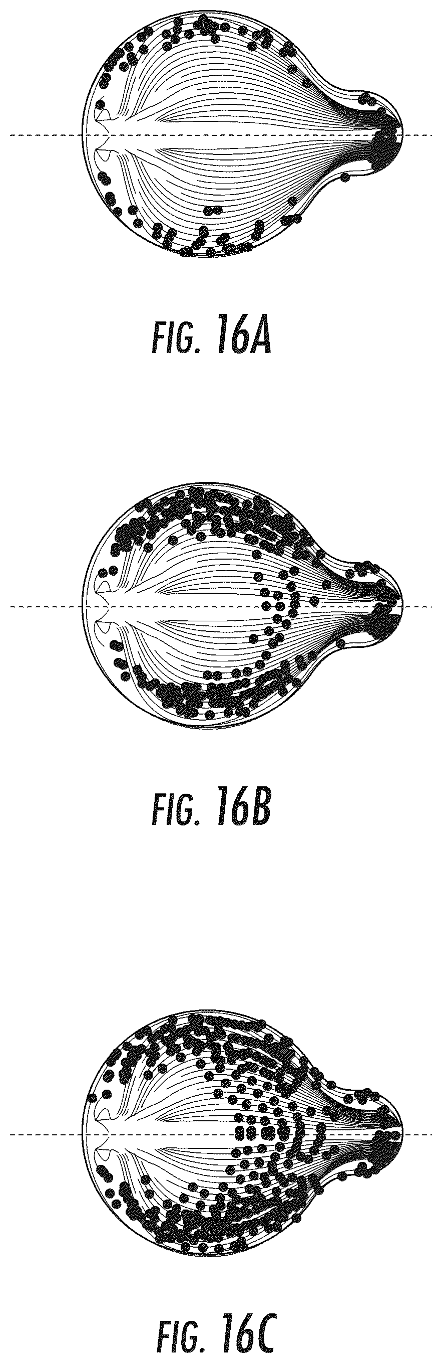 Patent US12551691 Figure 10 – Implantable reservoir for use with a medical device and system for interventional drug delivery