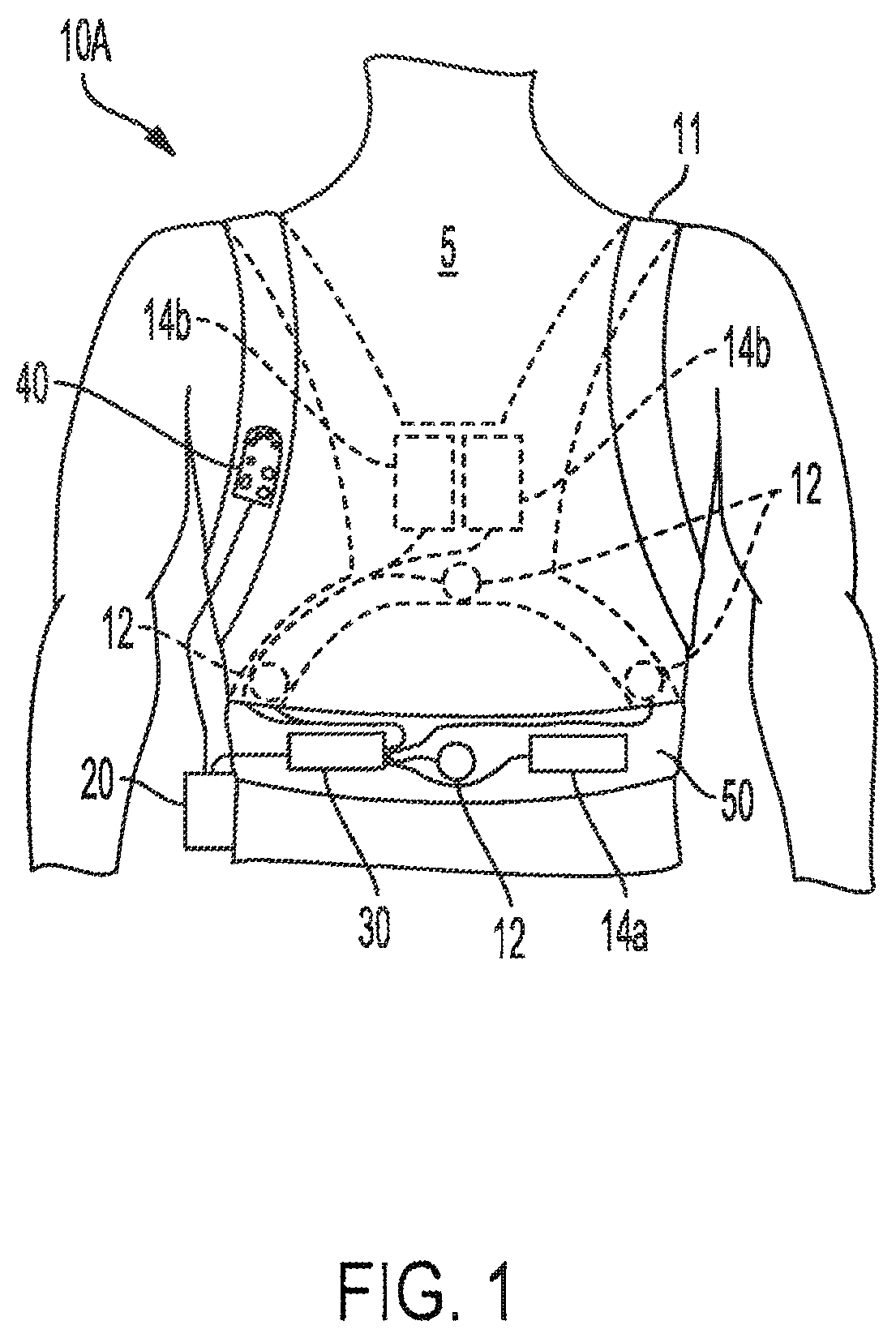 Patent US12551693 Figure 1 – Adhesively coupled wearable medical device