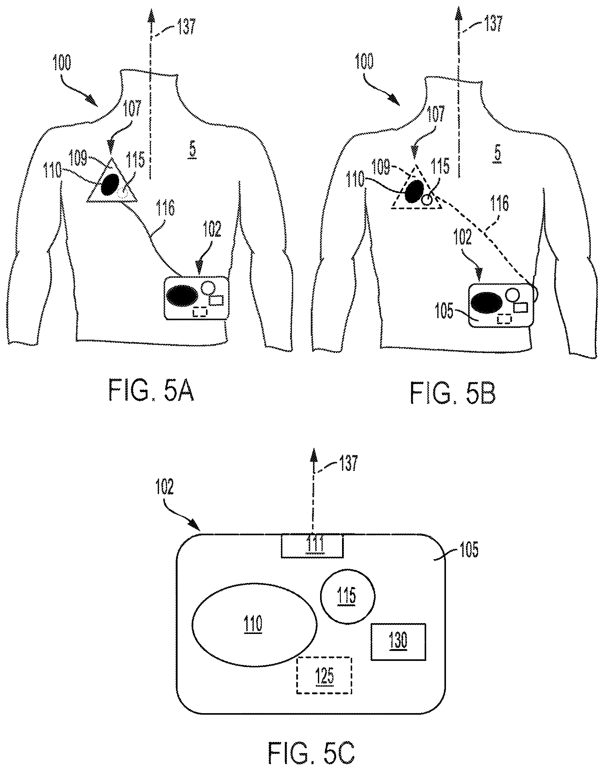 Patent US12551693 Figure 5 – Adhesively coupled wearable medical device