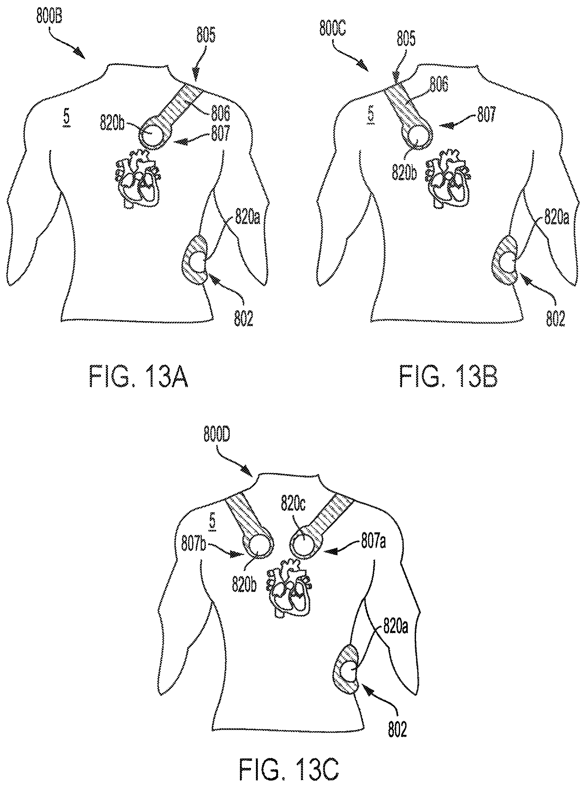 Patent US12551693 Figure 14 – Adhesively coupled wearable medical device