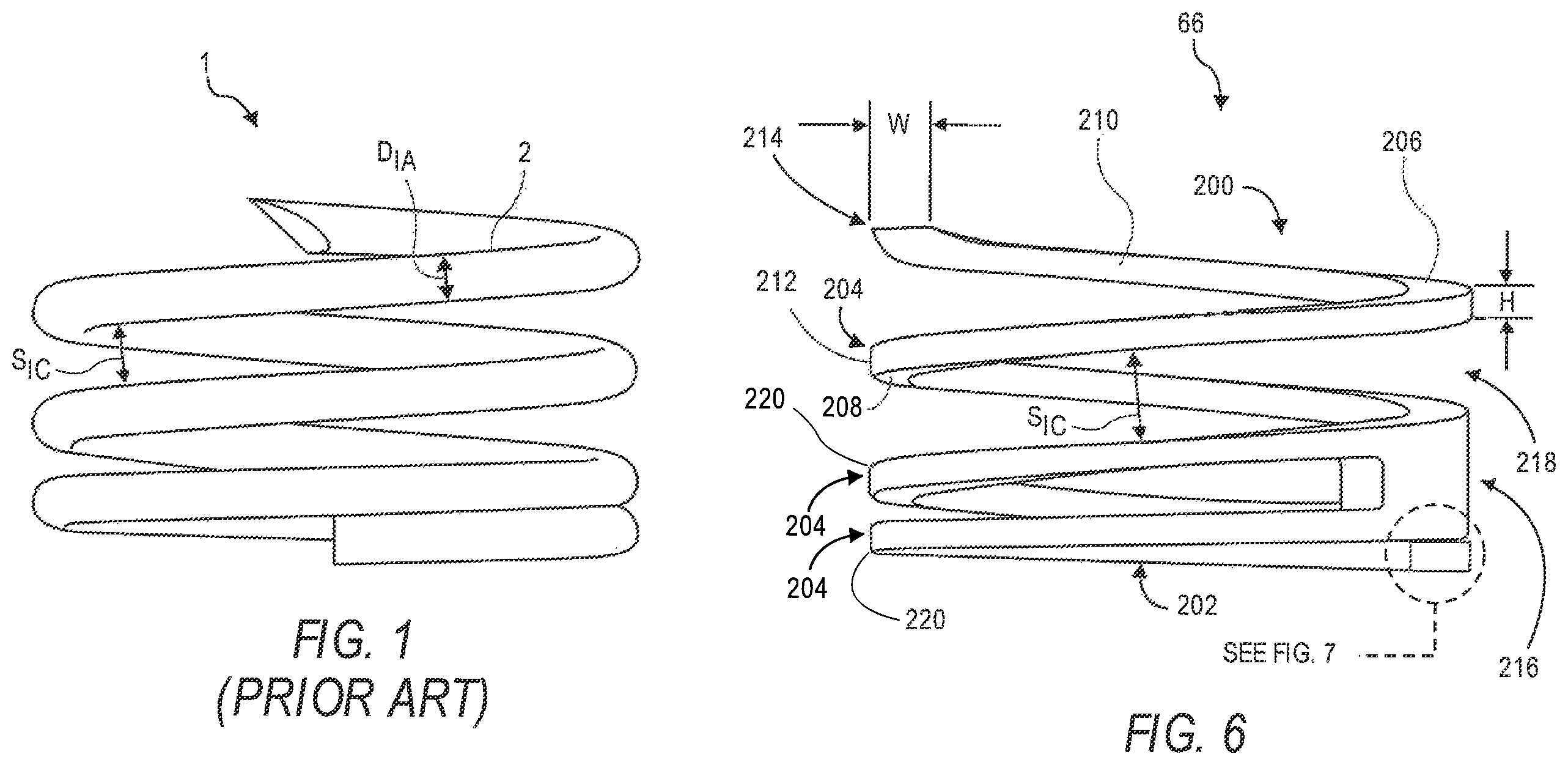 Patent US12551695 Figure 1 – Tube-cut helical fixation anchor for electrotherapy device