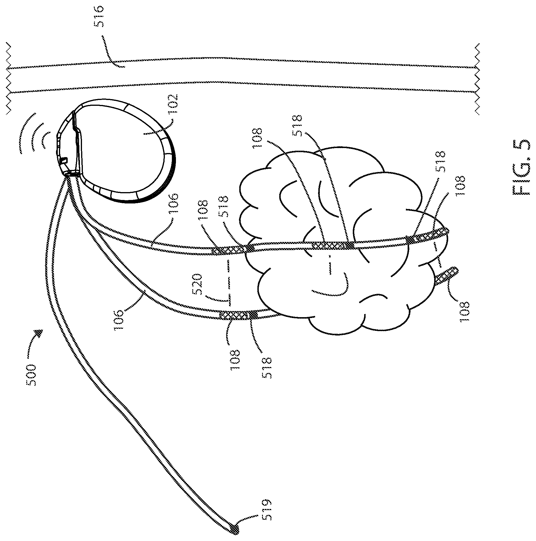 Patent US12551698 Figure 3 – Electrical stimulation with thermal treatment or thermal monitoring