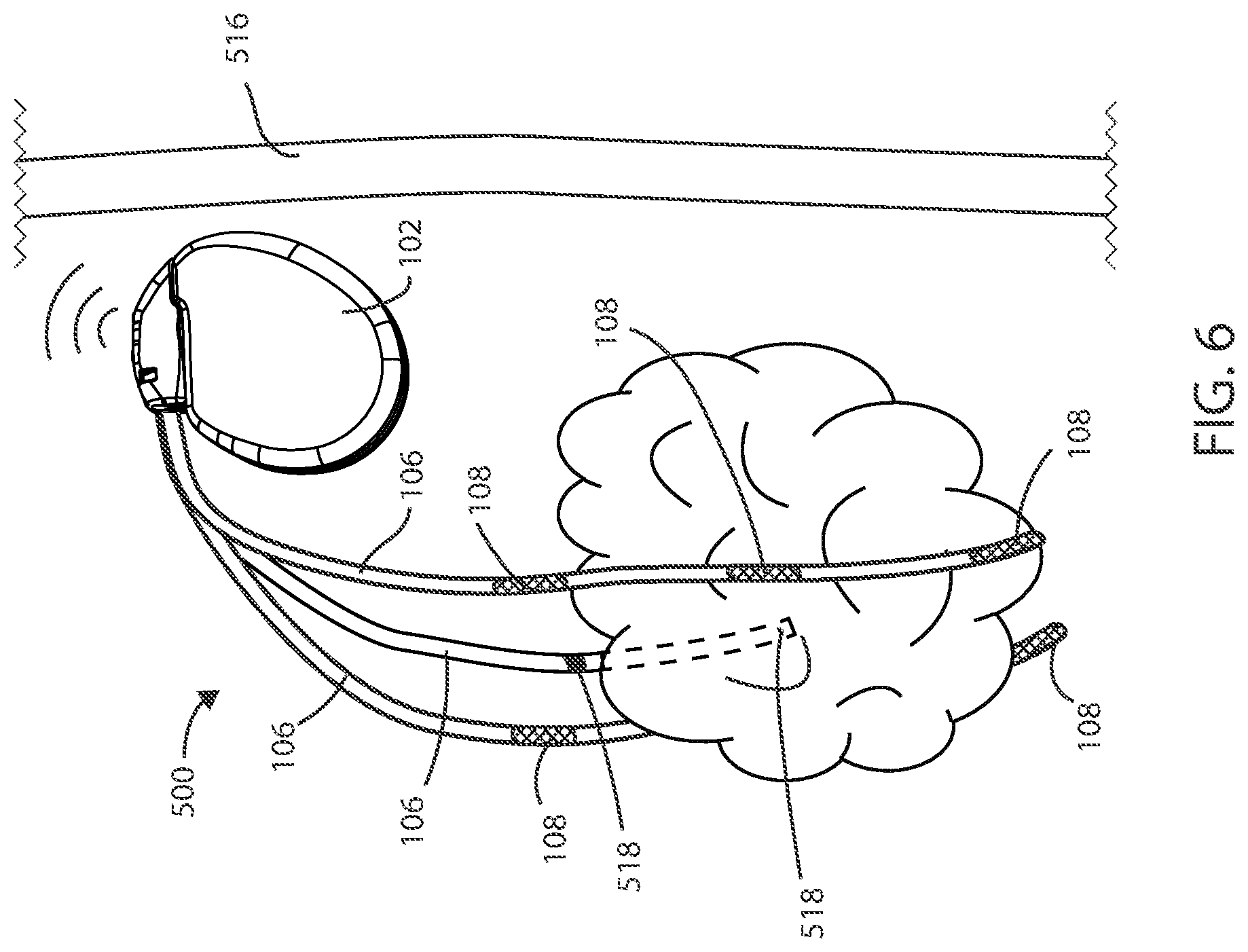 Patent US12551698 Figure 4 – Electrical stimulation with thermal treatment or thermal monitoring