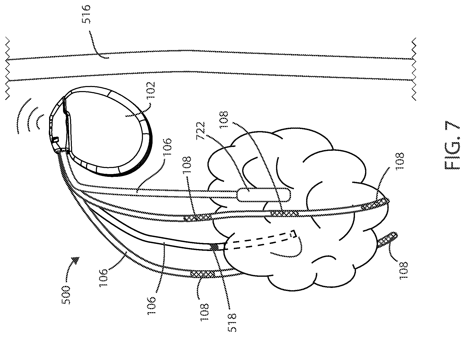 Patent US12551698 Figure 5 – Electrical stimulation with thermal treatment or thermal monitoring