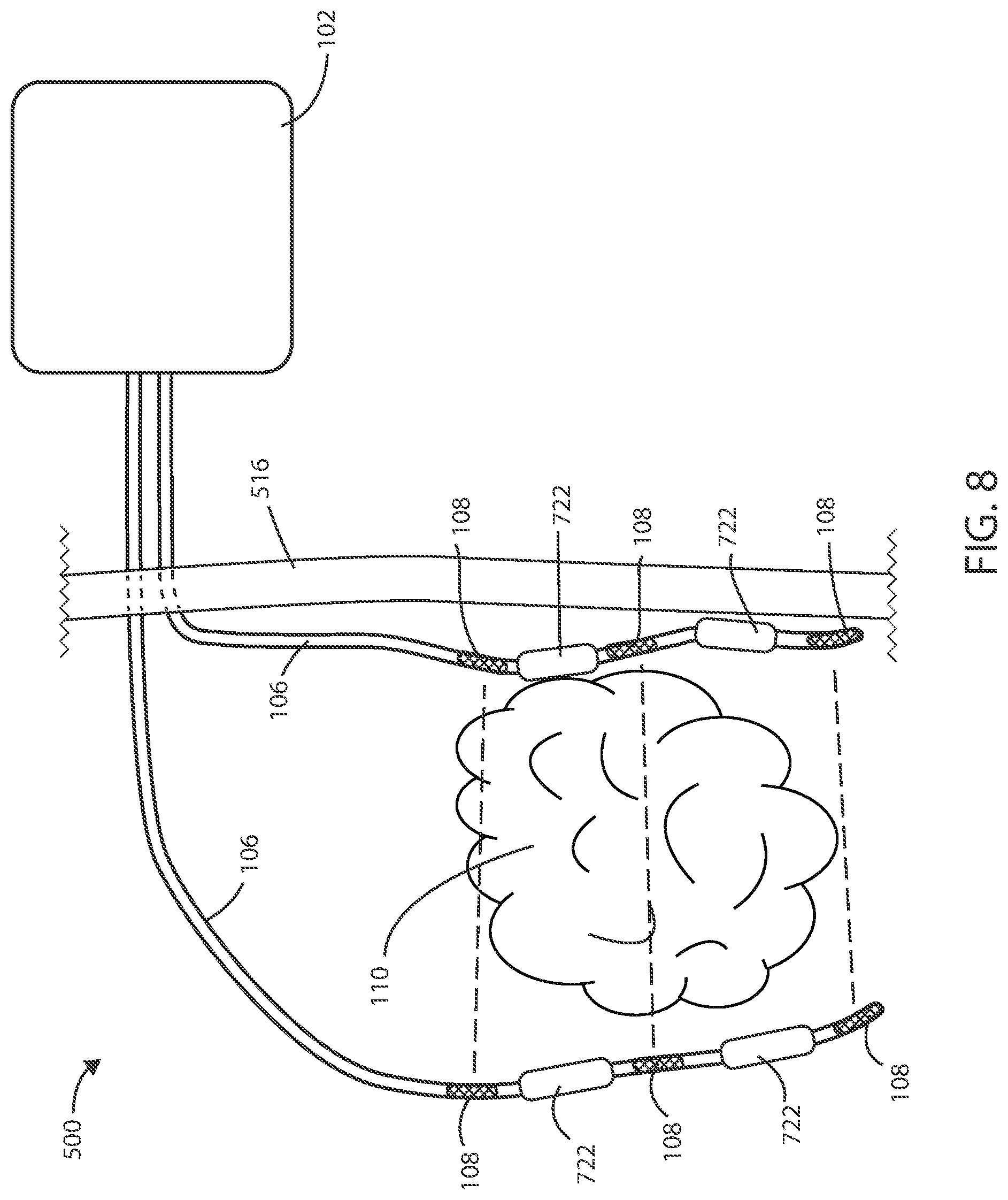 Patent US12551698 Figure 6 – Electrical stimulation with thermal treatment or thermal monitoring