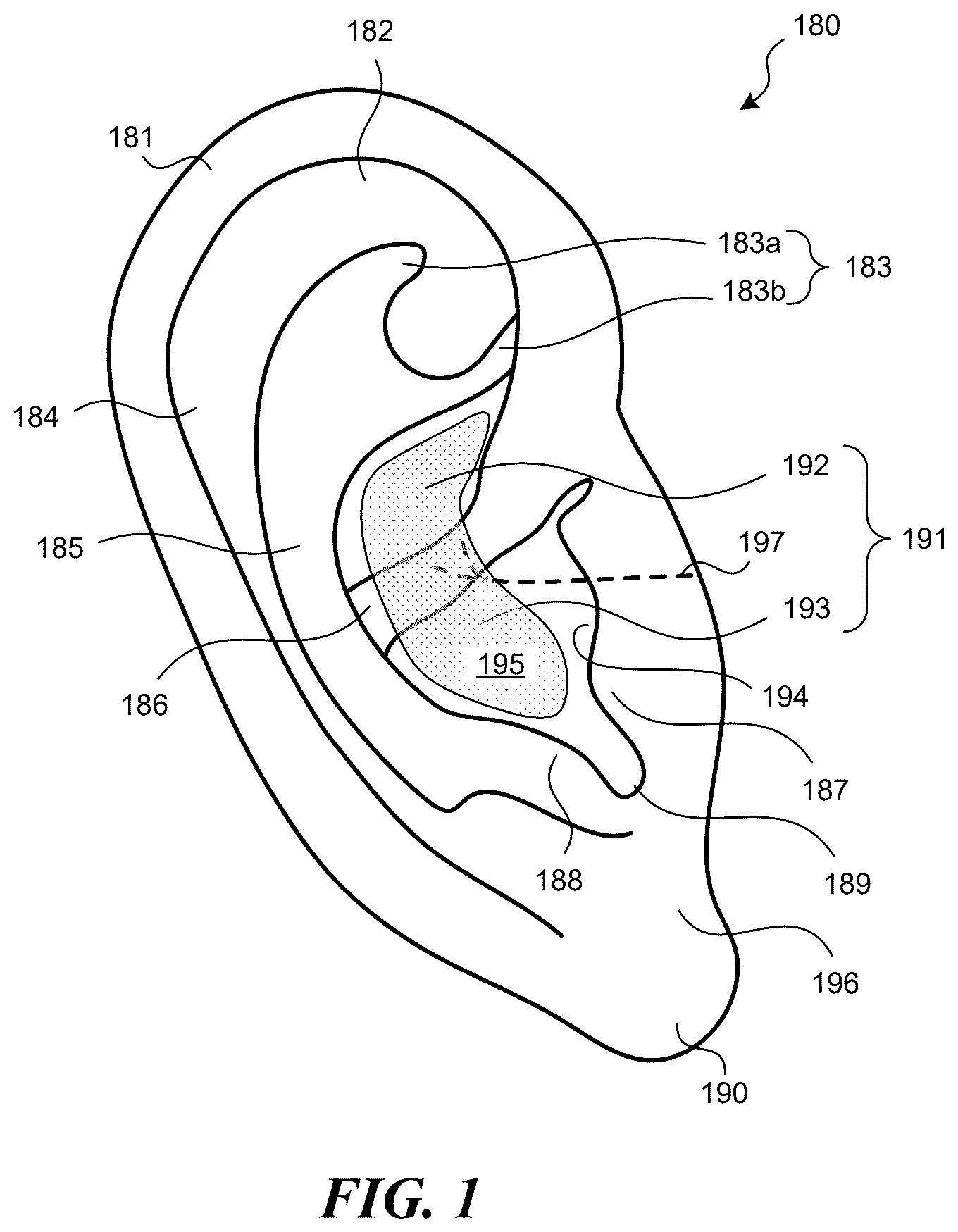 Patent US12551700 Figure 1 – Adjustable auricular nerve stimulation devices, and associated systems and methods