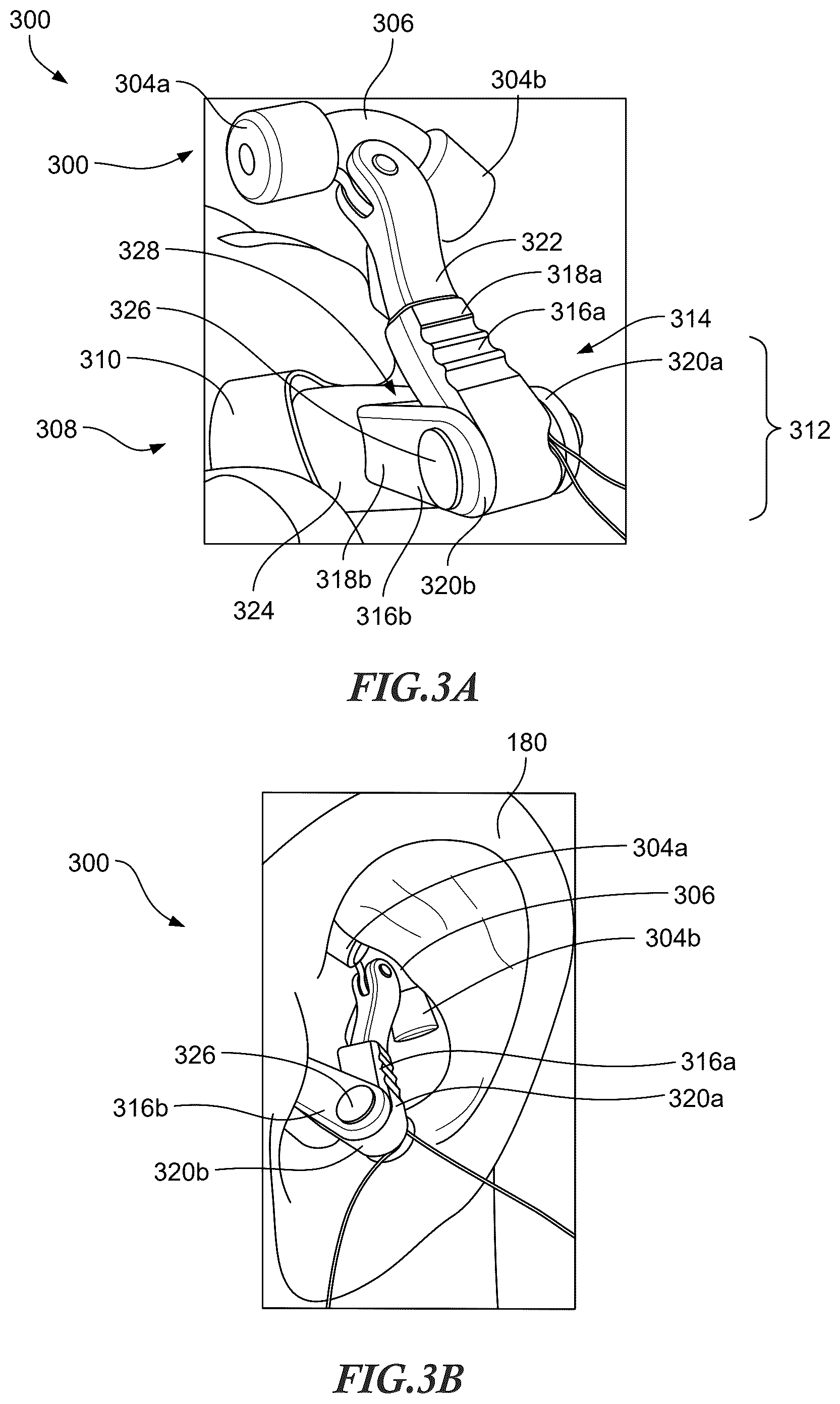 Patent US12551700 Figure 3 – Adjustable auricular nerve stimulation devices, and associated systems and methods