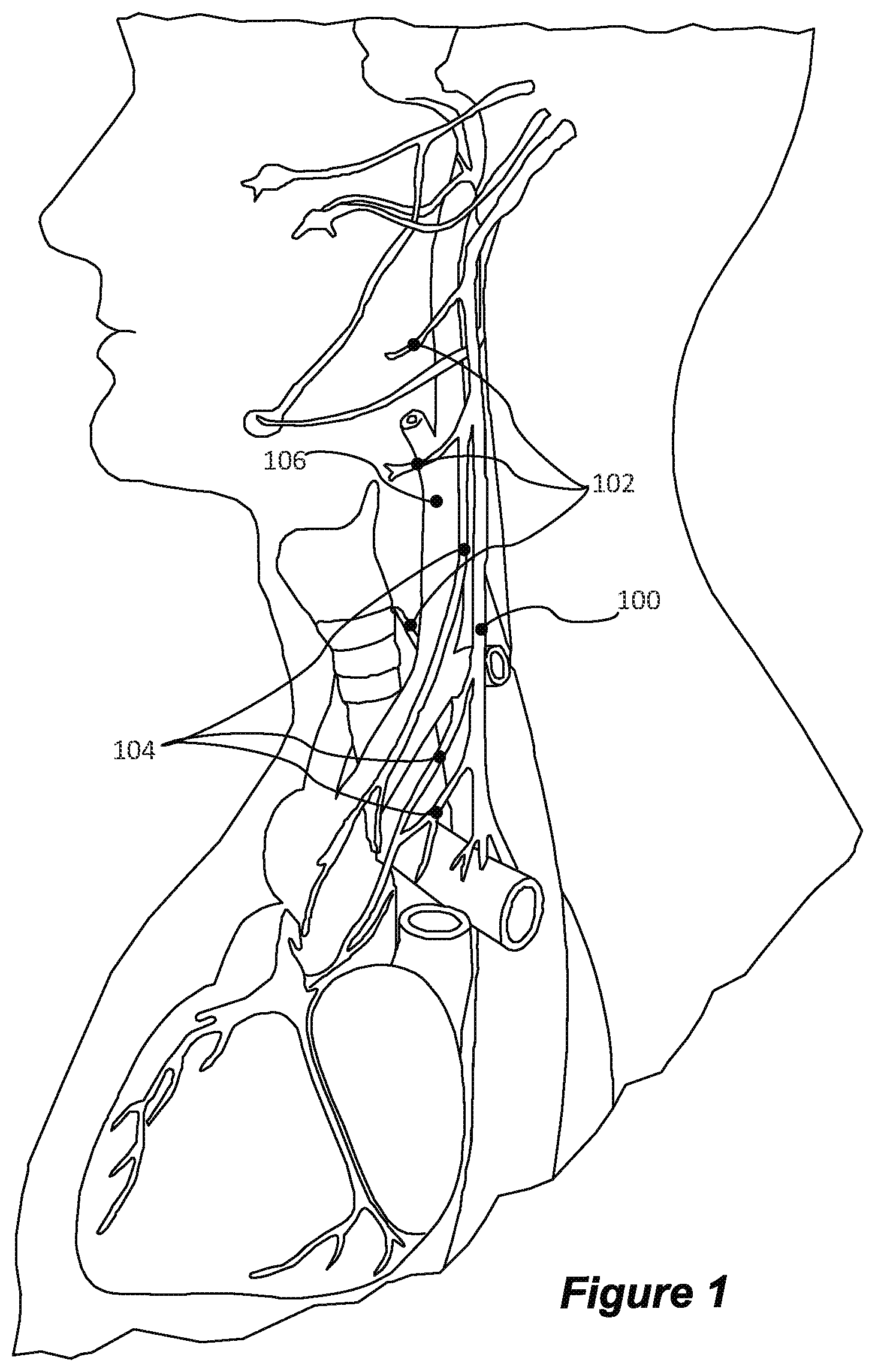 Patent US12551702 Figure 1 – Selective stimulation of peripheral nerves