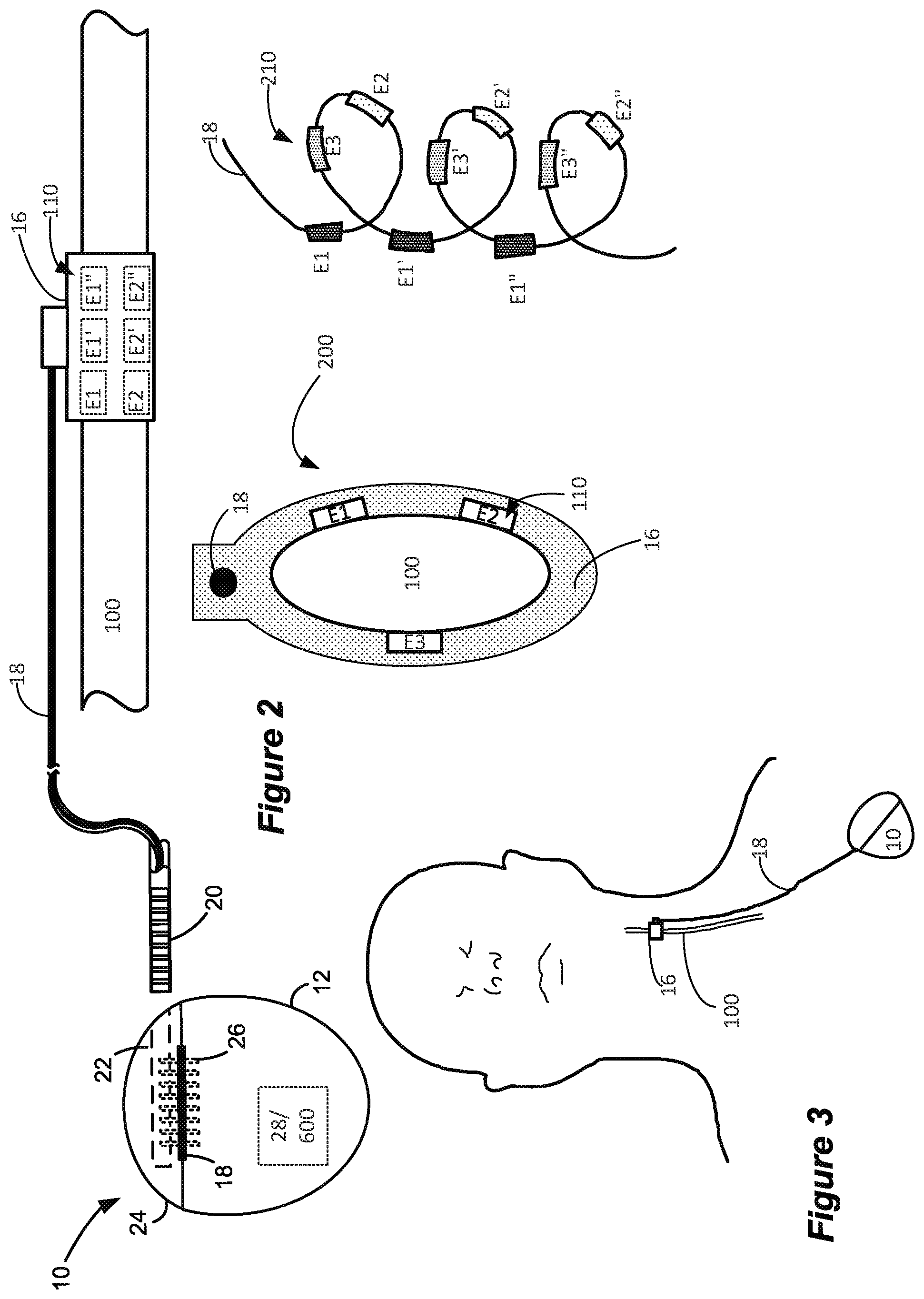 Patent US12551702 Figure 2 – Selective stimulation of peripheral nerves