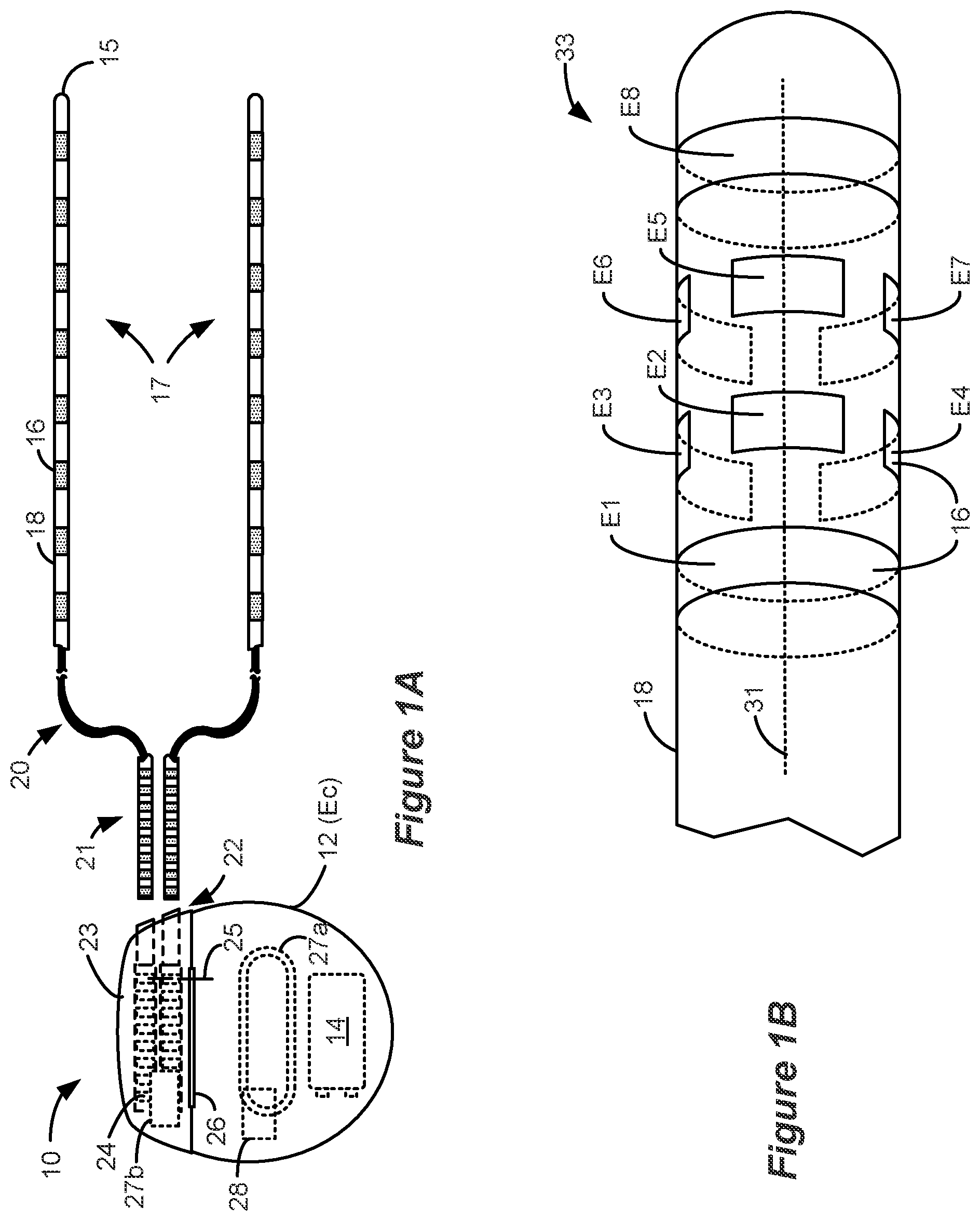 Patent US12551703 Figure 1 – Adaptive deep brain stimulation based on neural signals with dynamics