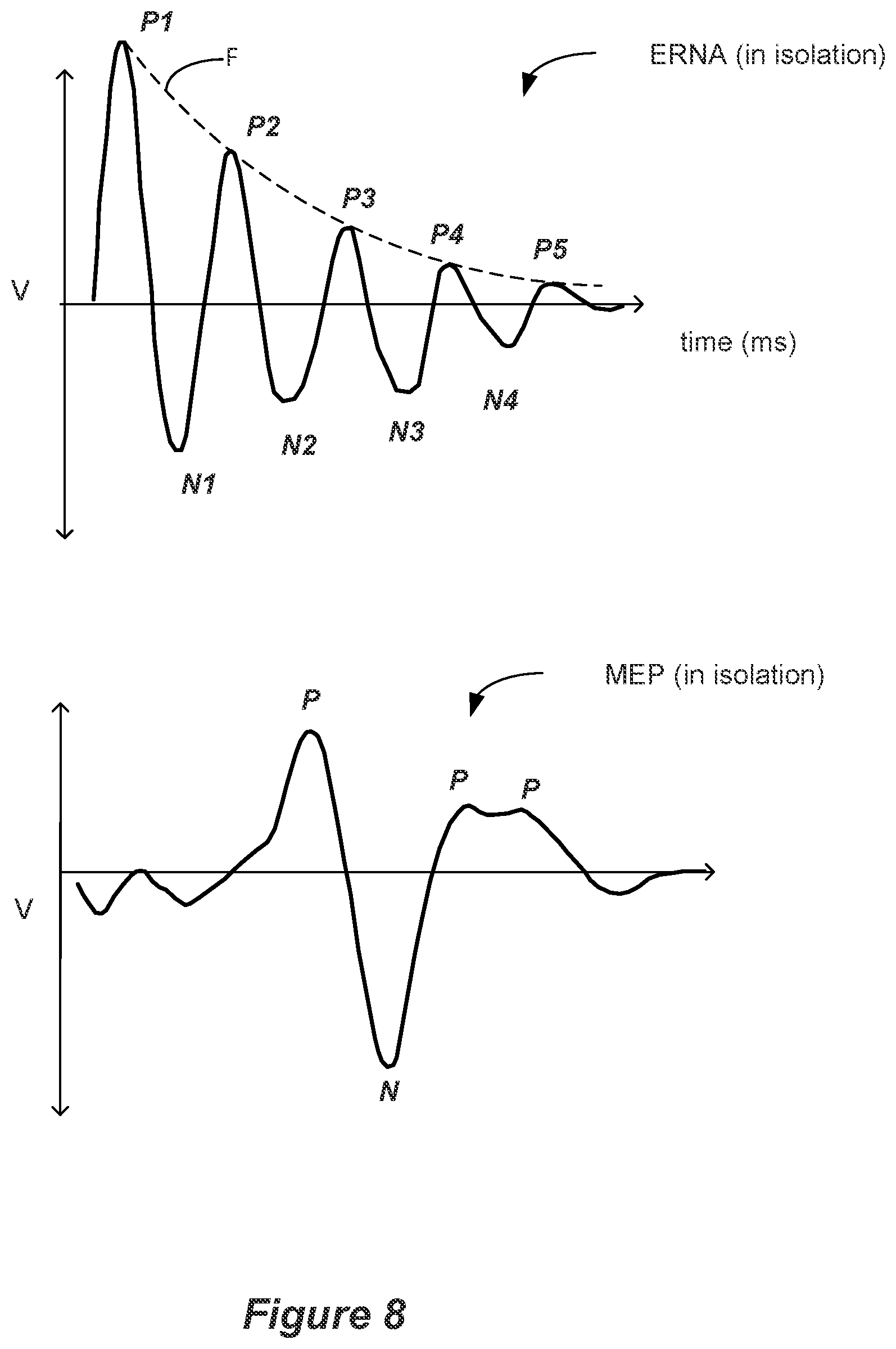 Patent US12551703 Figure 6 – Adaptive deep brain stimulation based on neural signals with dynamics
