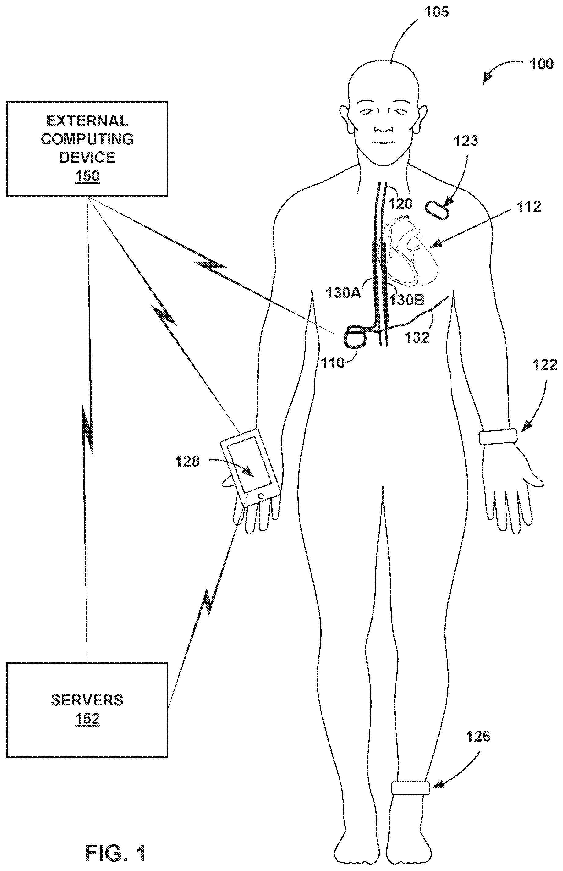 Patent US12551704 Figure 1 – Environment-responsive neurostimulation pain therapy optimization