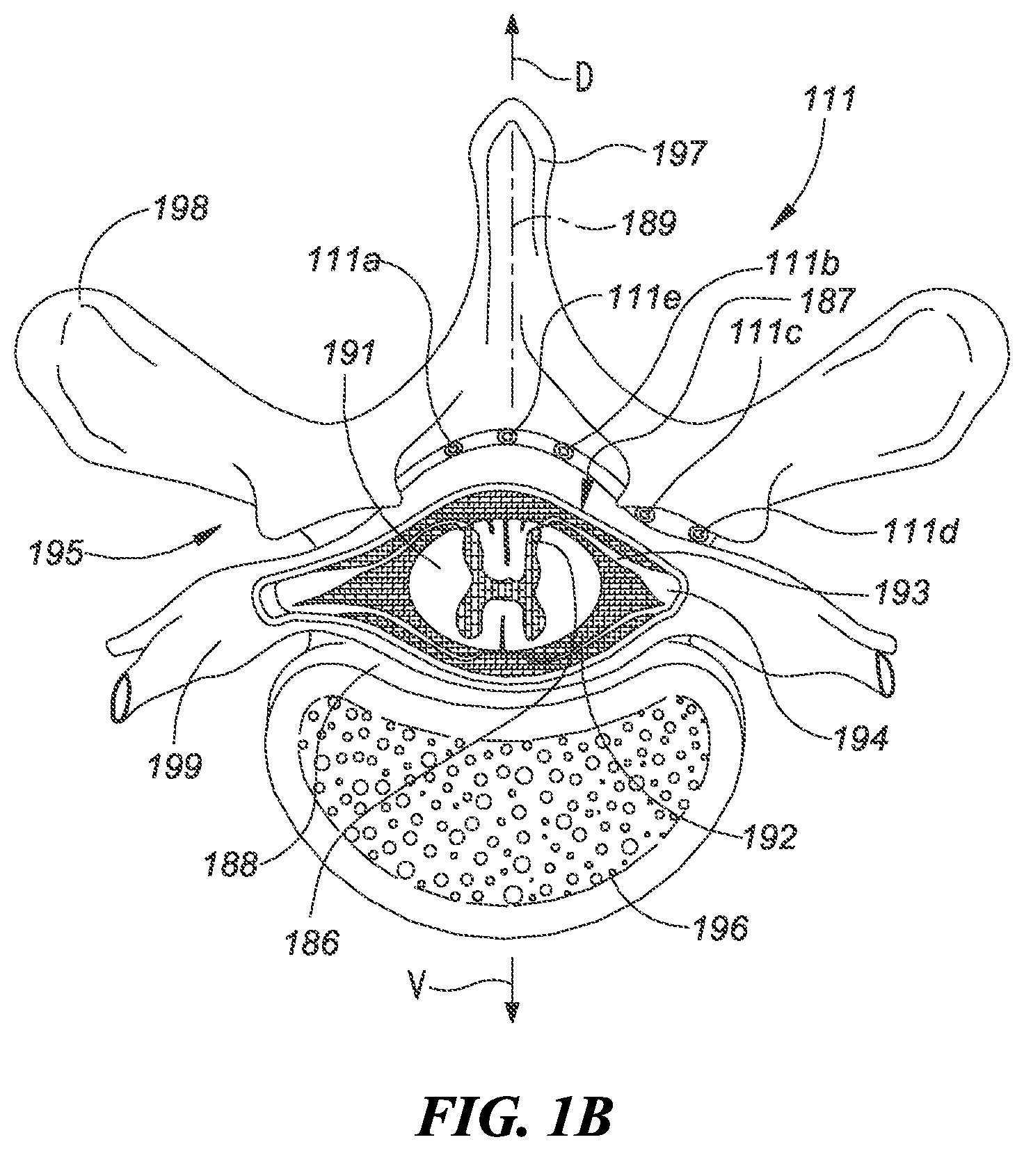 Patent US12551705 Figure 2 – Efficient use of an implantable pulse generator battery, and associated systems and methods
