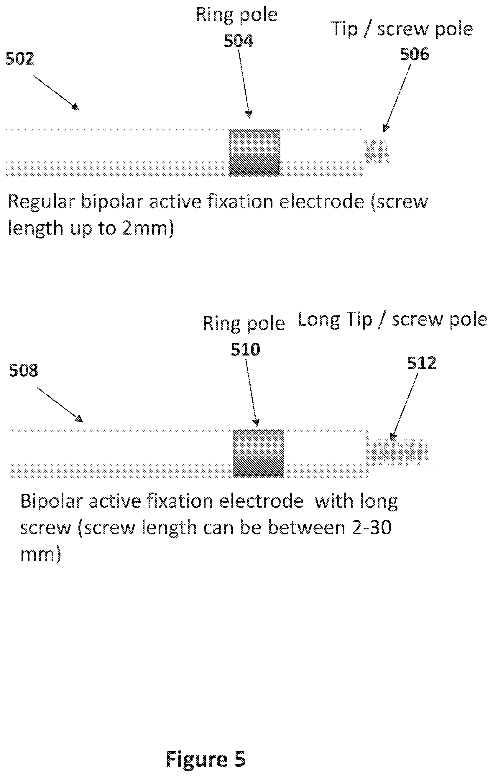 Patent US12551707 Figure 5 – Means and methods for using non-excitatory electrical heart failure therapy as a therapy for heart failure with preserved ejection fraction