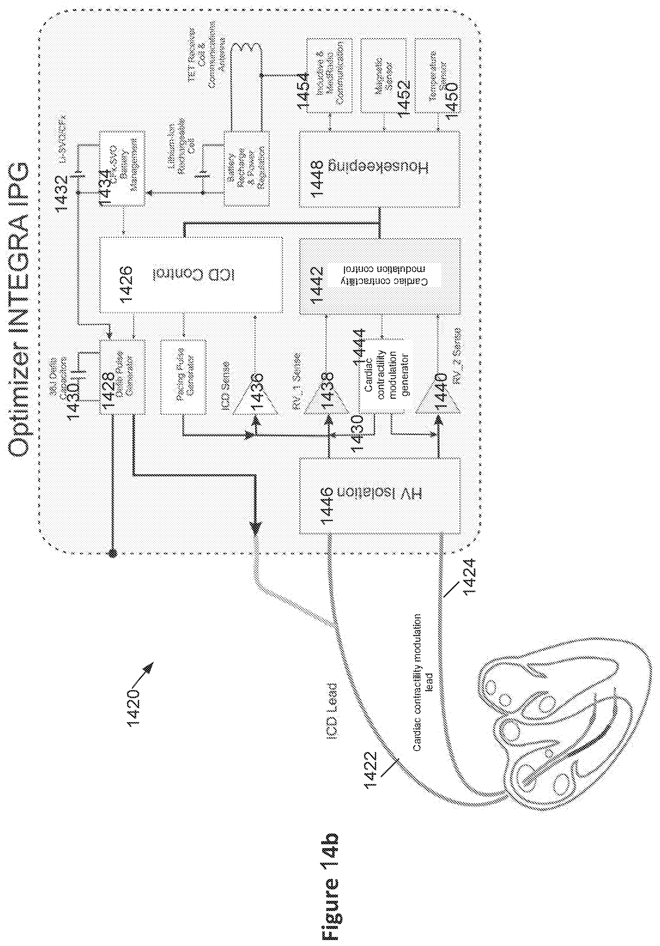Patent US12551707 Figure 15 – Means and methods for using non-excitatory electrical heart failure therapy as a therapy for heart failure with preserved ejection fraction