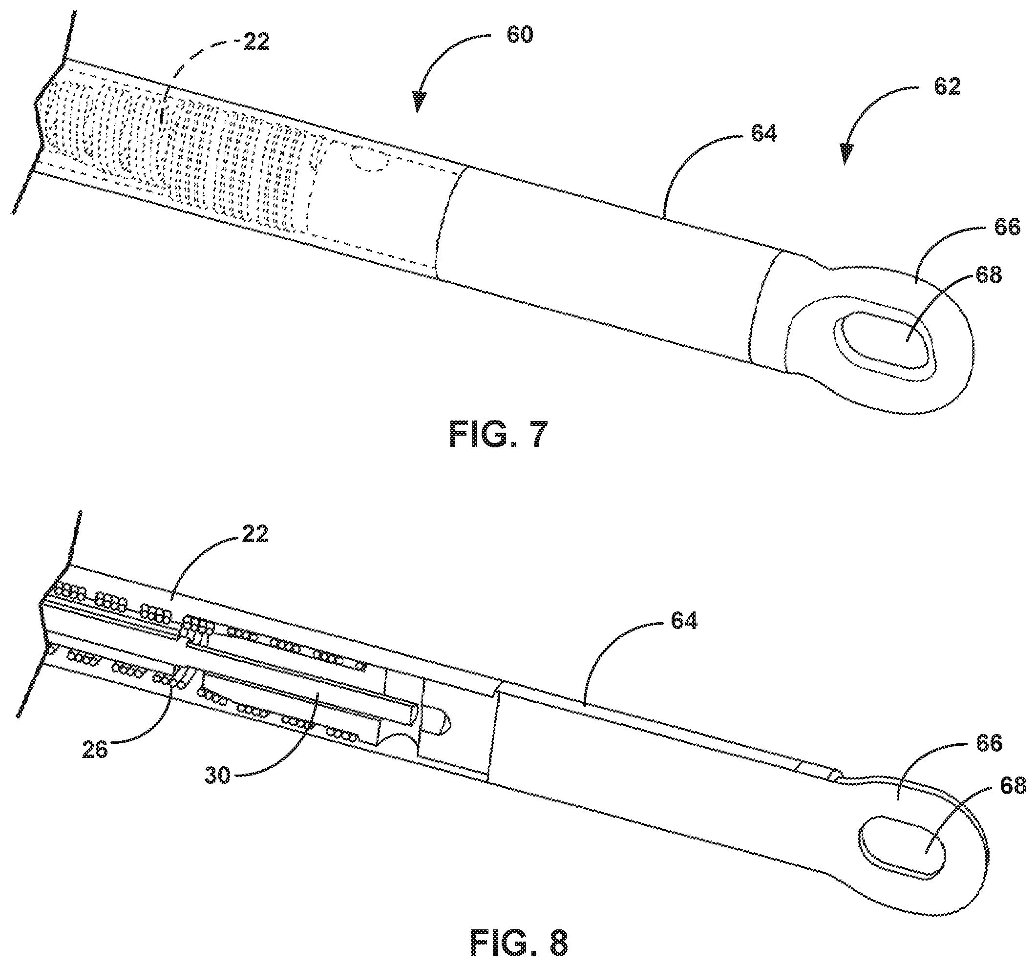 Patent US12551709 Figure 5 – Leadless pacing system including sensing extension